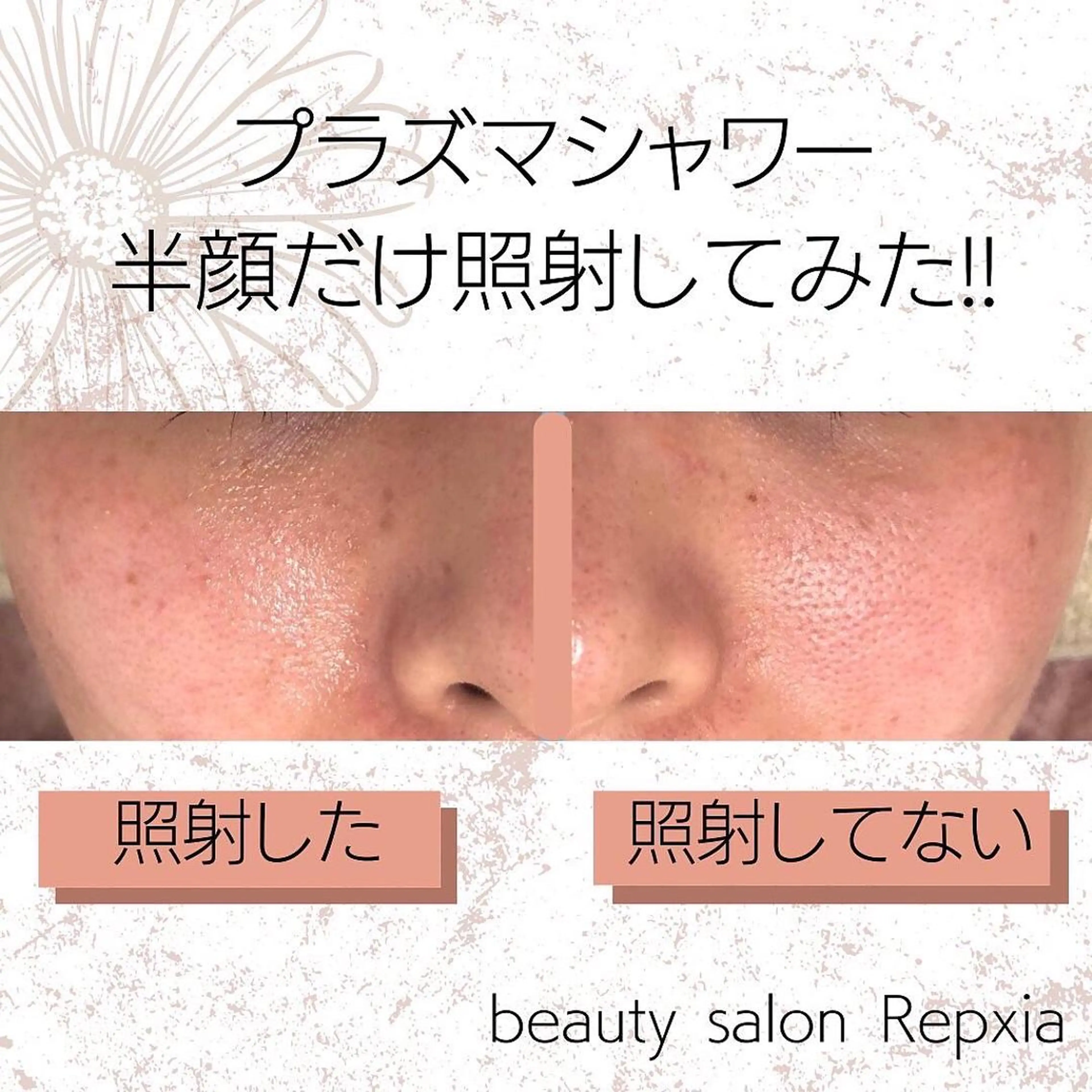 エステ calla lily 増田のエステ・リラクイメージ