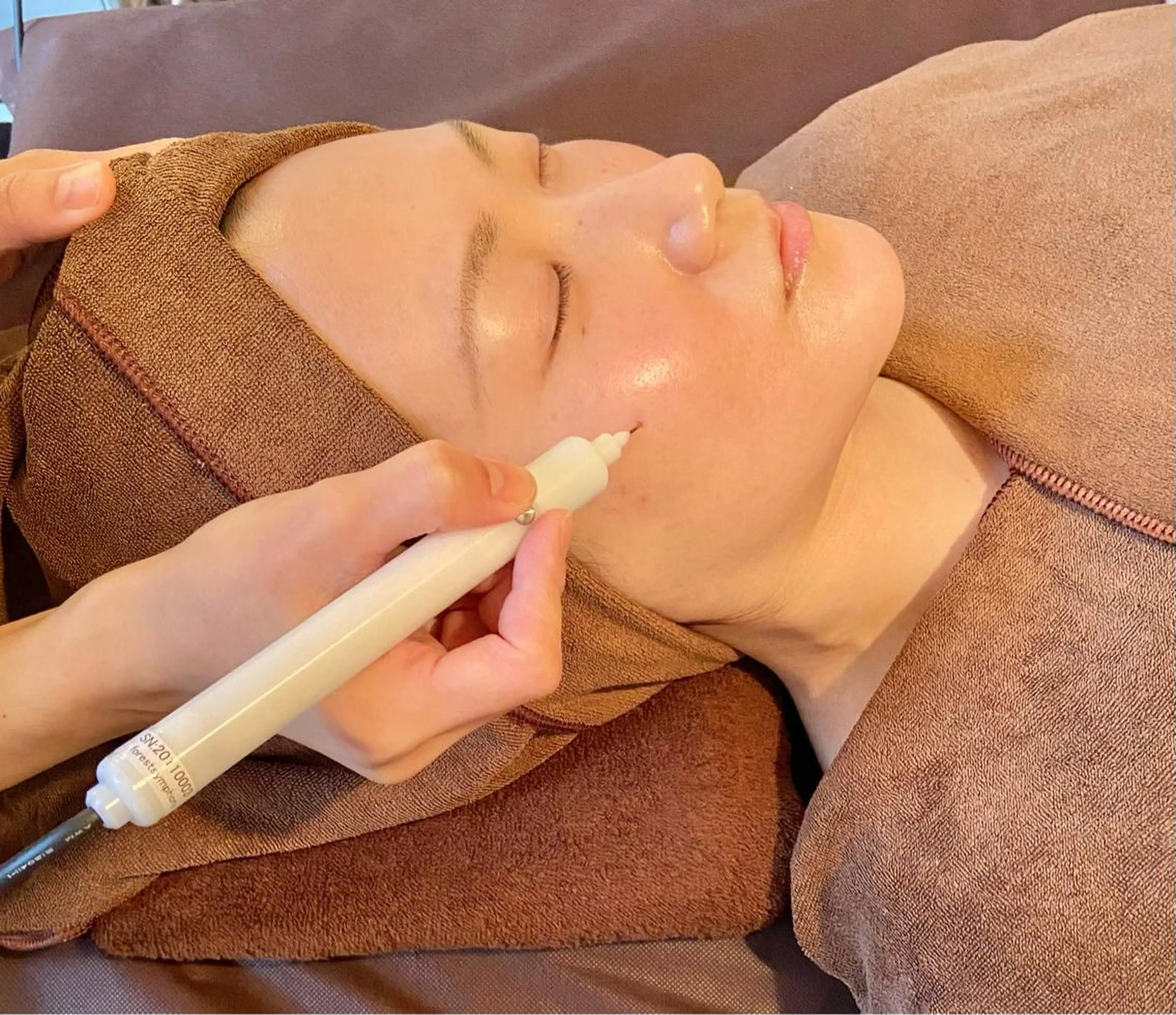 【シミケア】直接アプローチ！10分当て放題2ミリ×20箇所の写真