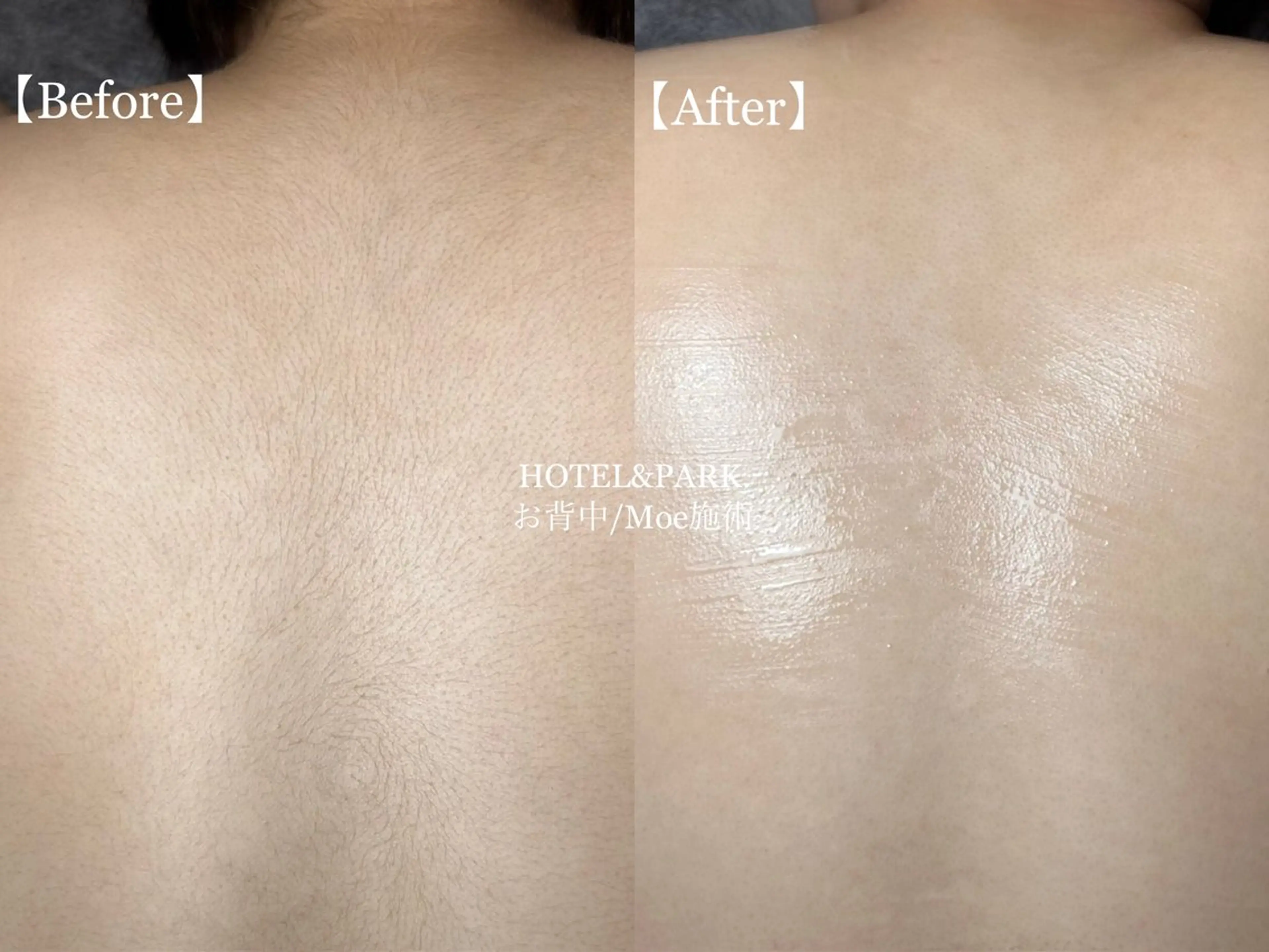 HOTEL&PARK . ワックス脱毛のエステ・リラクイメージ