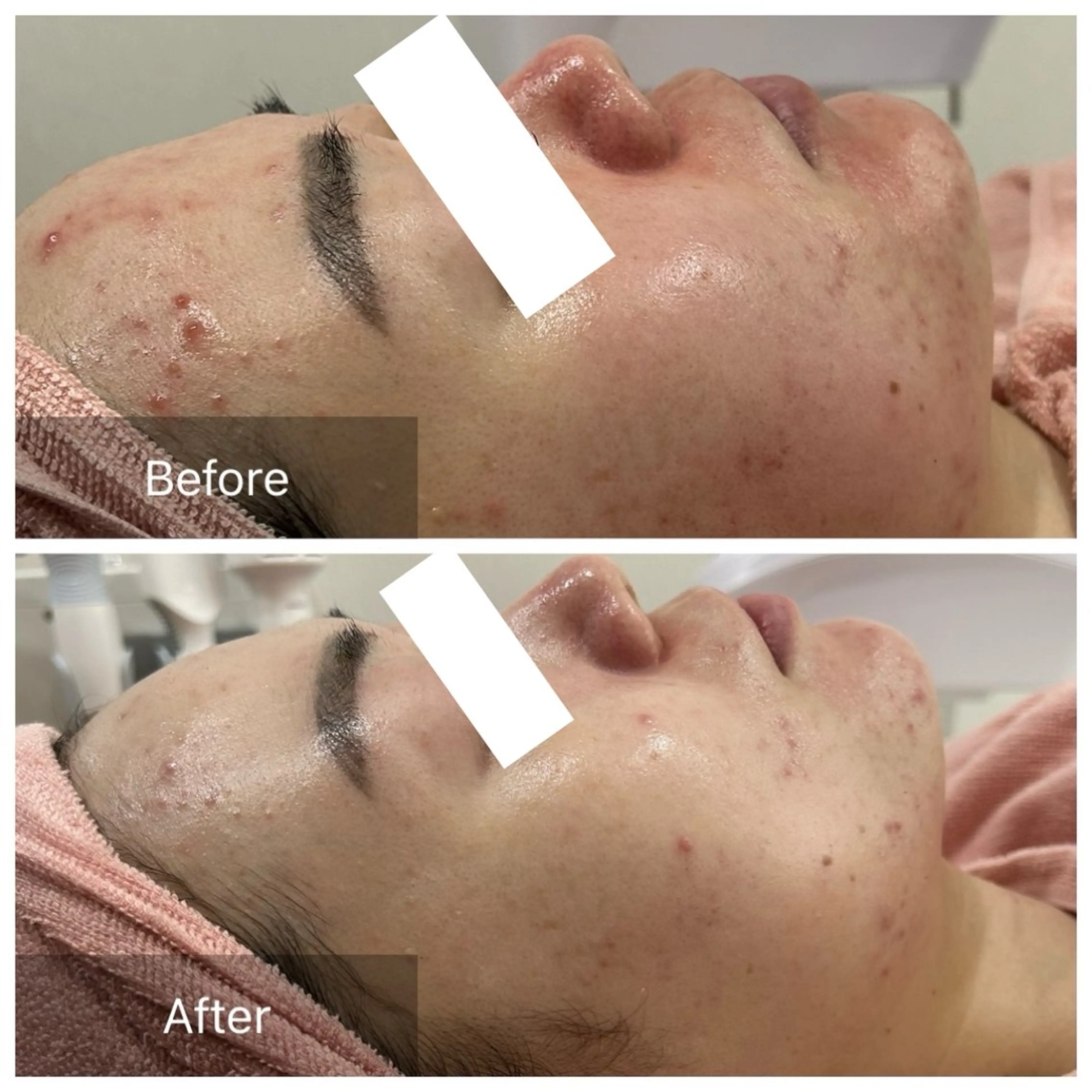 エステ 【現役看護師】高来 笑子のエステ・リラクイメージ