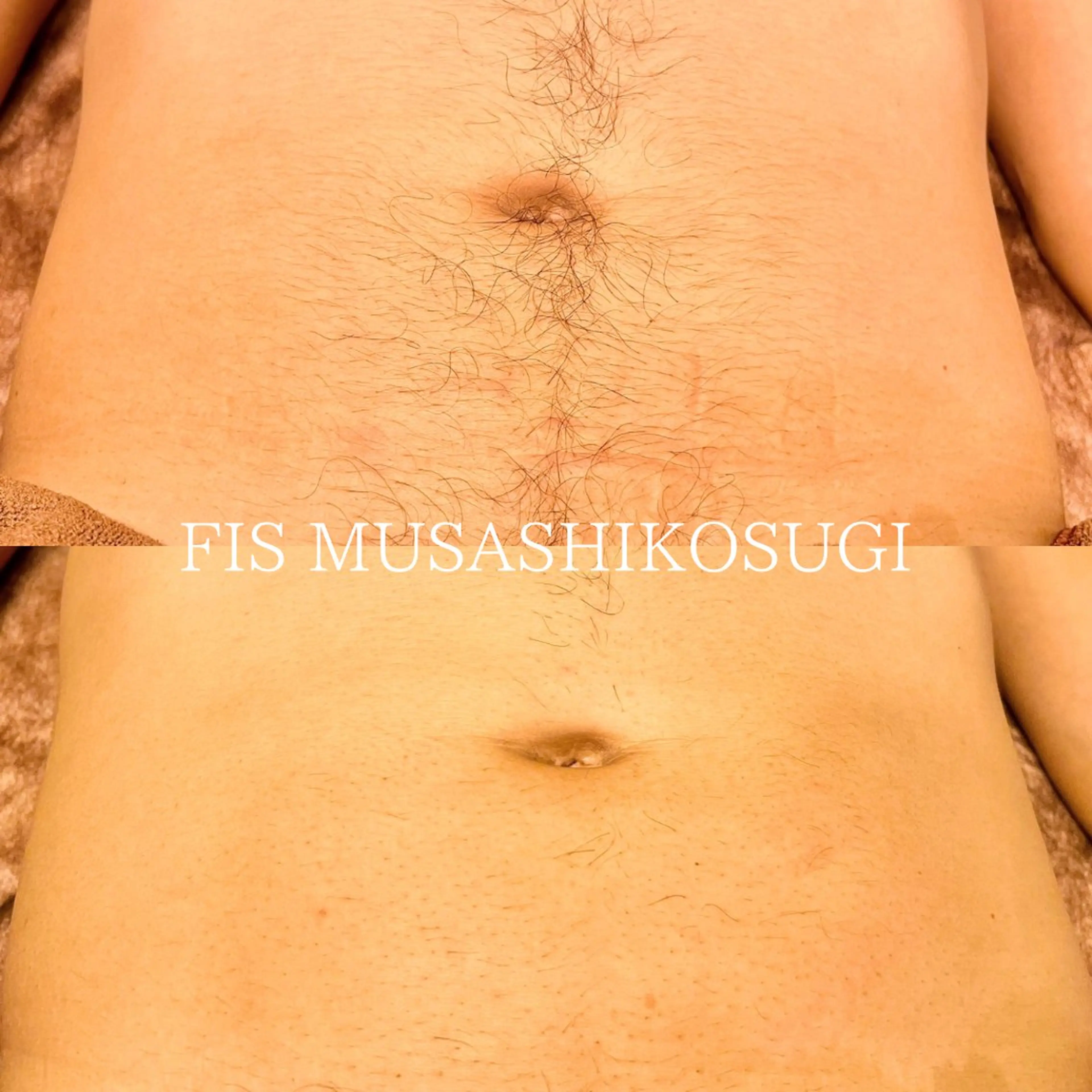 脱毛サロン&ハーブピーリングFIS武蔵小杉店所属・脱毛サロン FIS武蔵小杉店のエステ・リラクイメージ