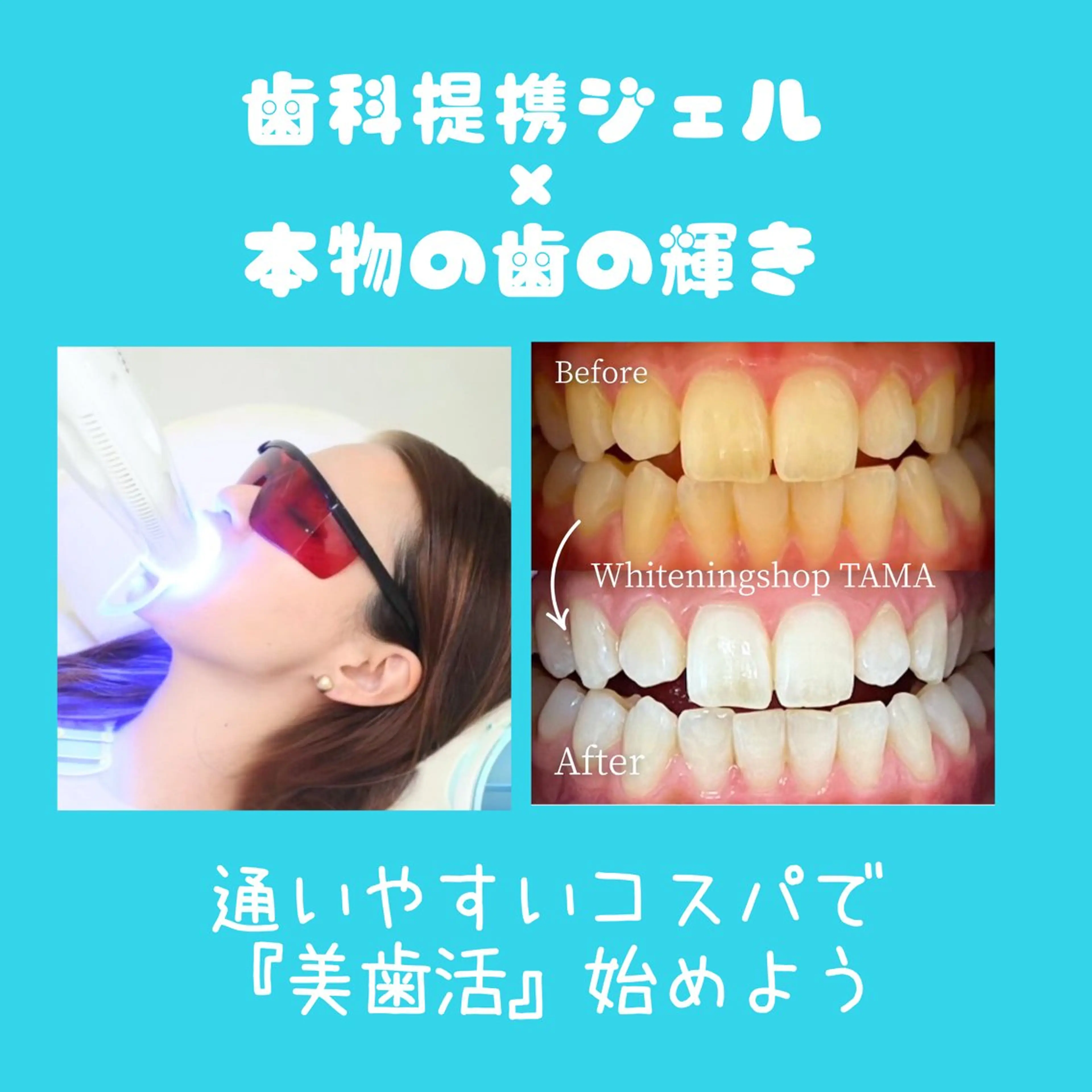 ホワイトニング ショップ多摩店のその他イメージ