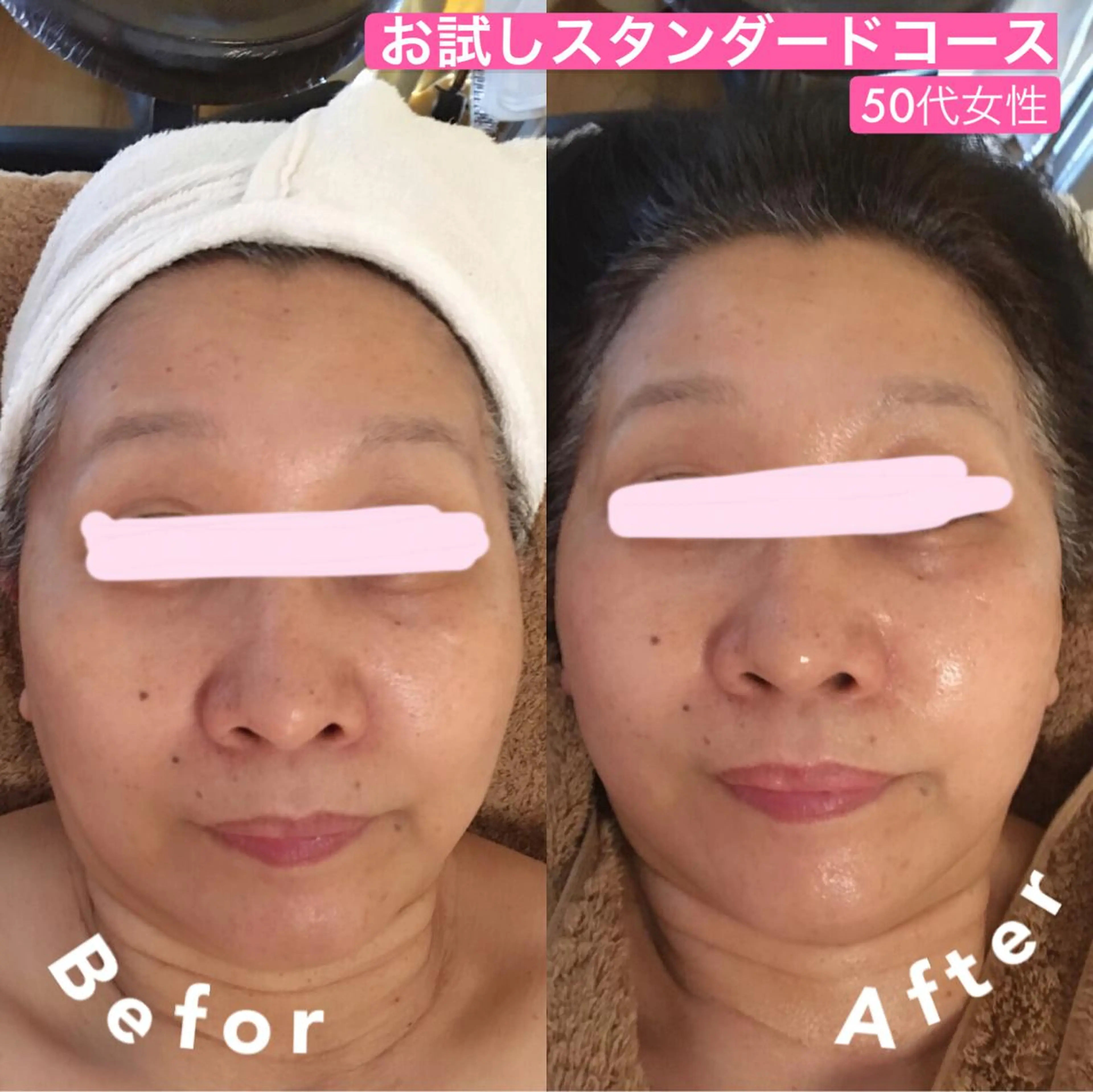 NORRA ノオラのエステ・リラクイメージ