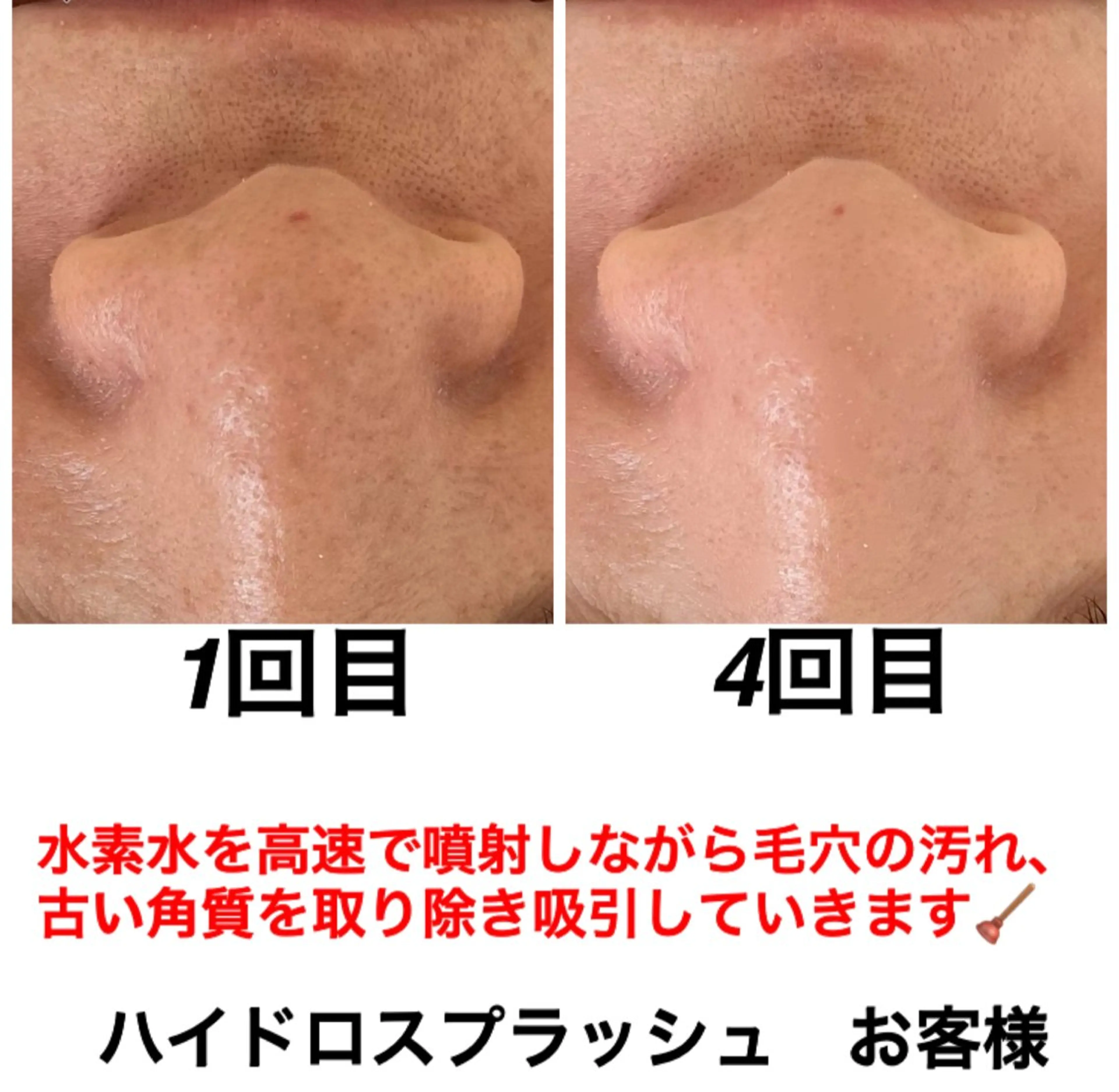 エステ リラク ネイル・エステサロンUILANI所属・ネイル・エステサロン UILANIのネイルデザイン