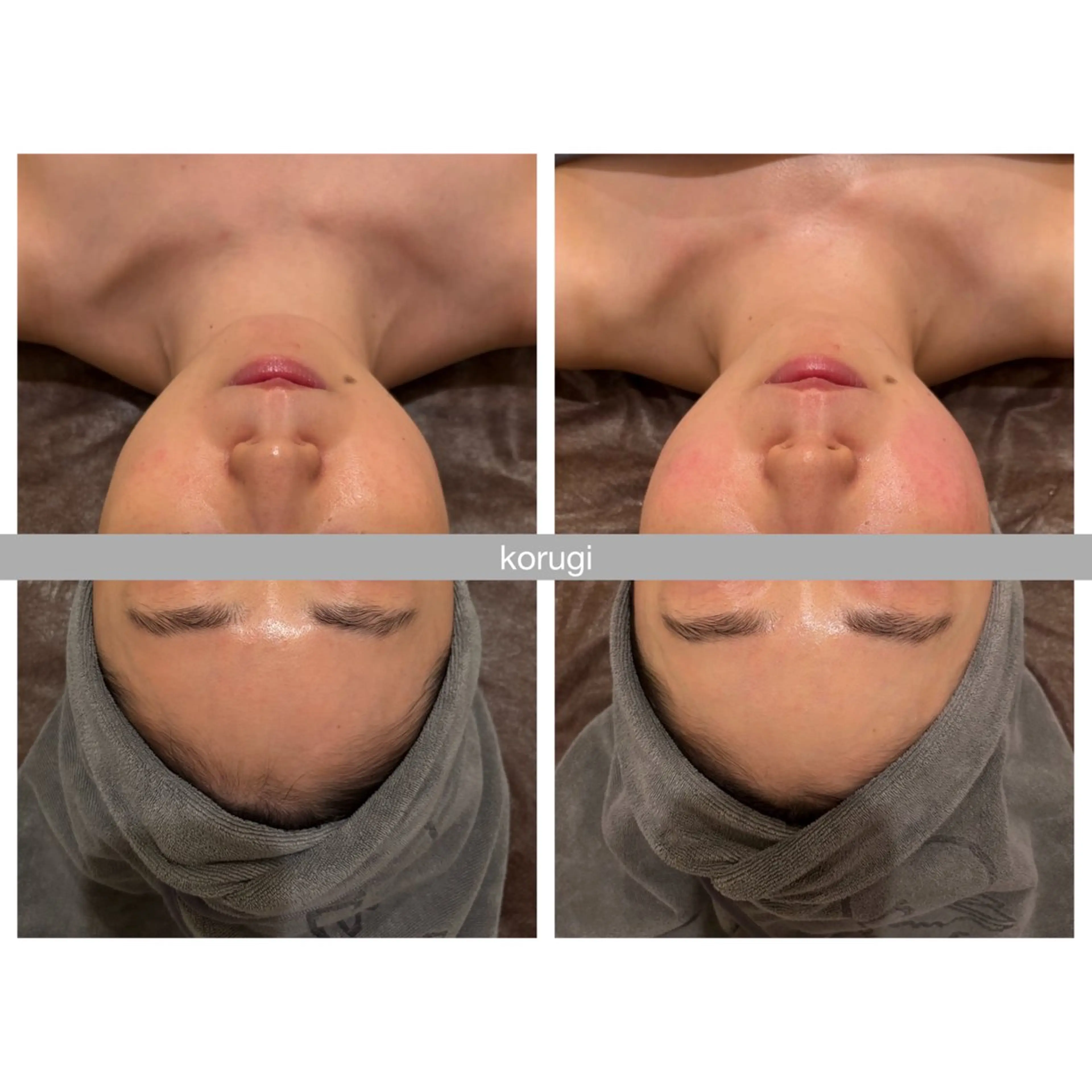 ☆痩身/小顔☆ コルギのエステ・リラクイメージ