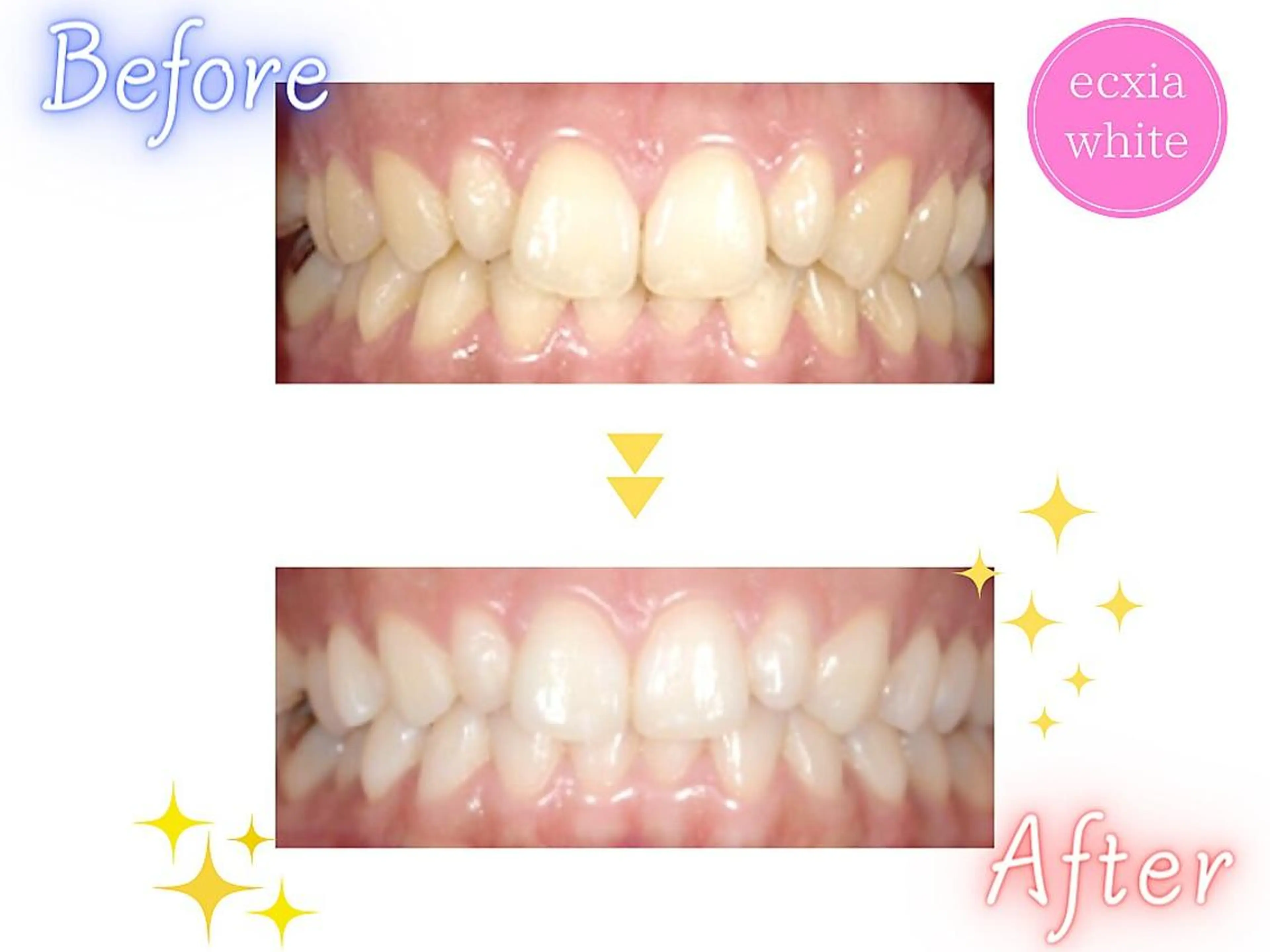 セルフホワイトニング エクシア　京都四条店のその他イメージ