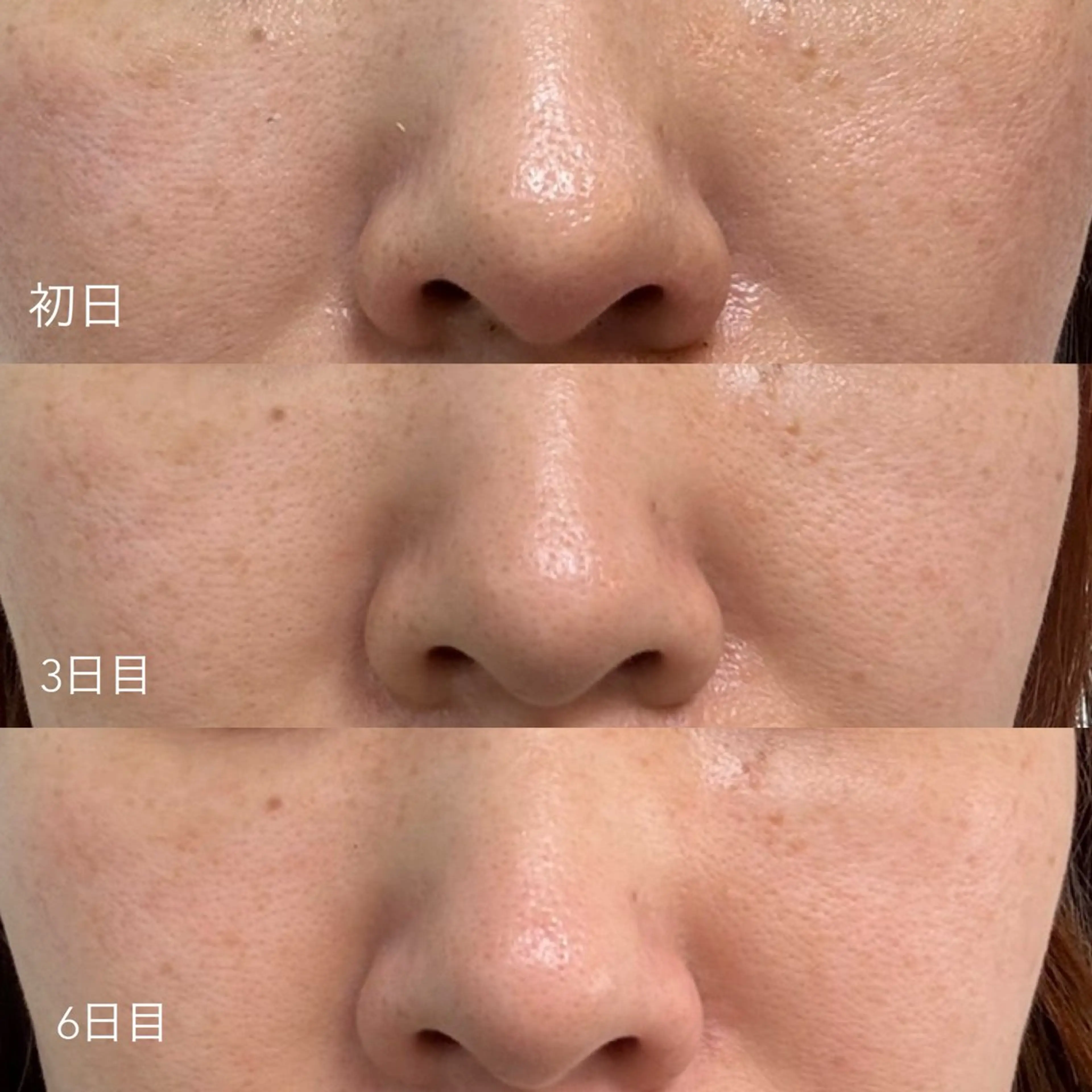 エステティックサロン Liente(リアンテ)所属・Hashimoto .のエステ・リラクイメージ