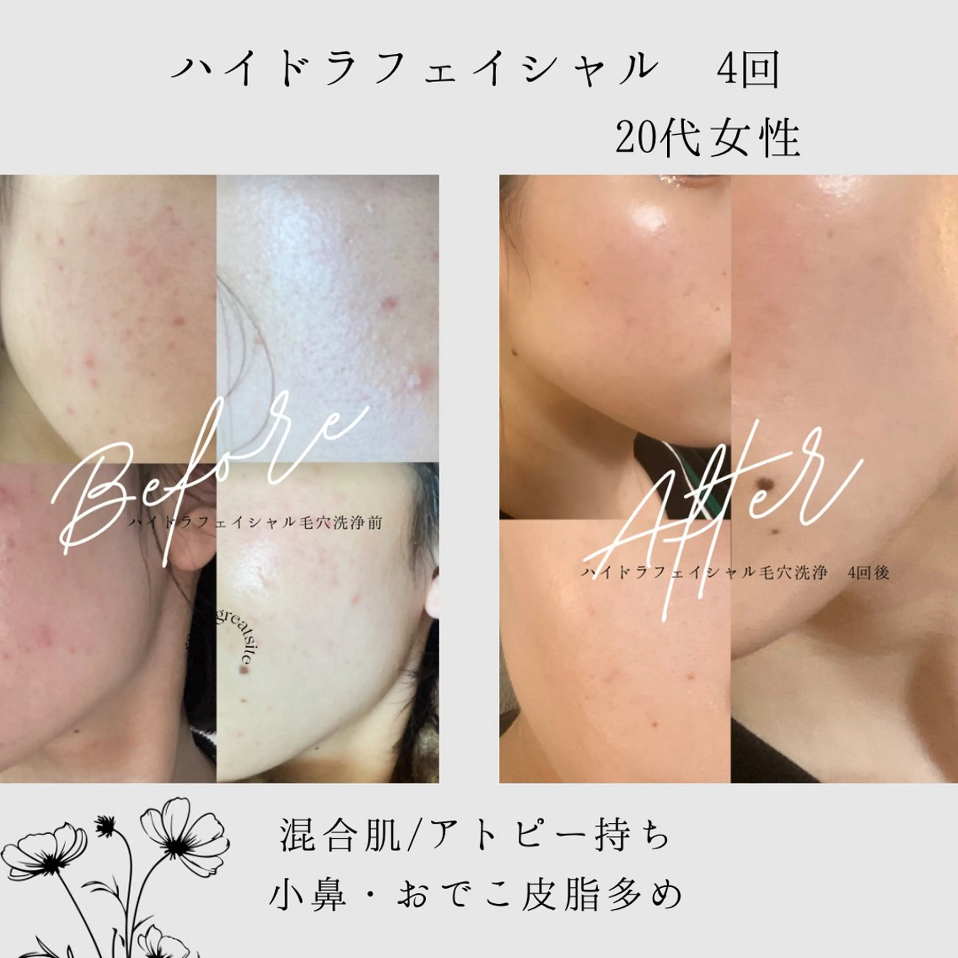 肌質改善サロン🌻 Nico laughのエステ・リラクイメージ