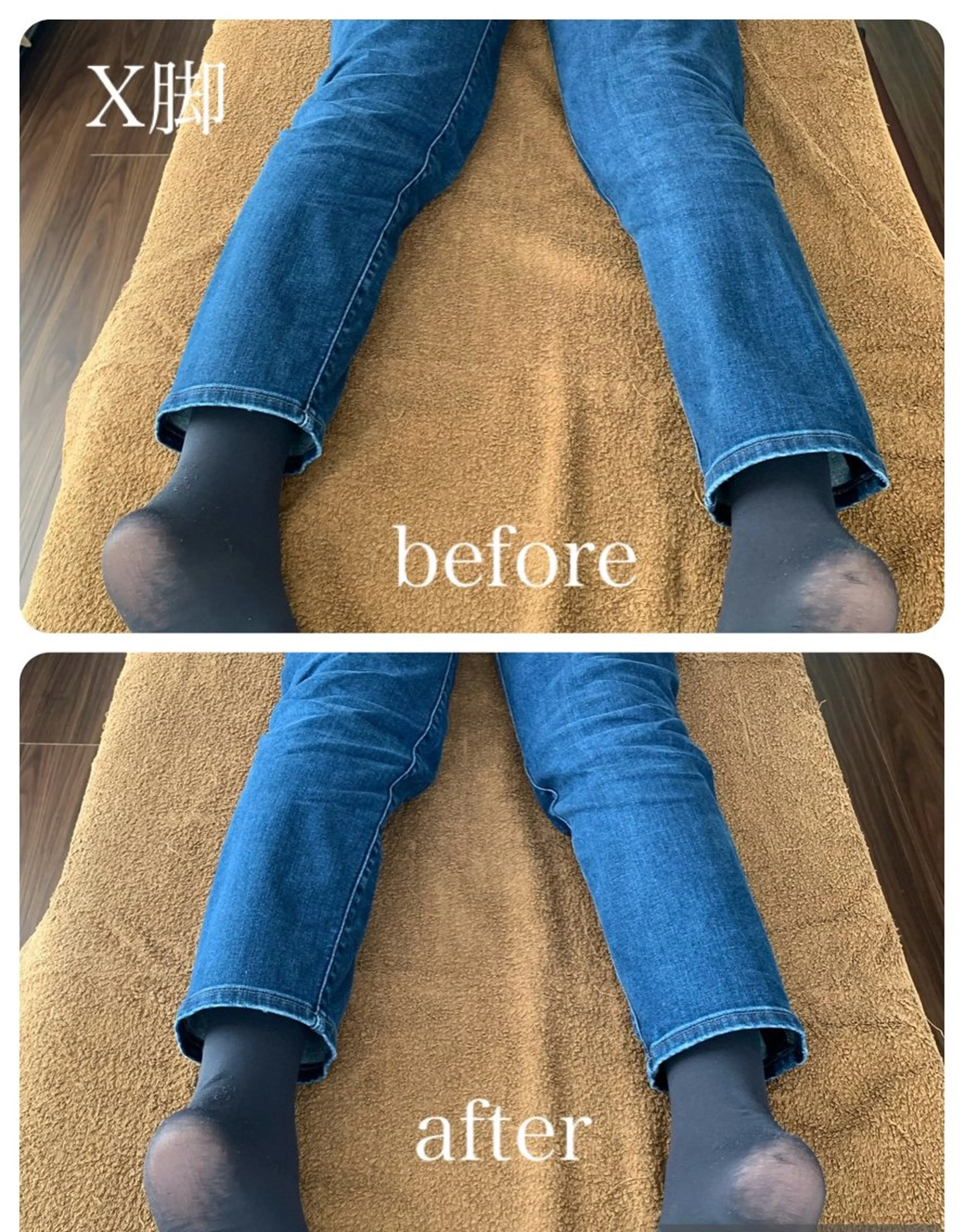 土日祭日限定❣️姿勢調整&骨盤&XO脚ケア45分コースの写真