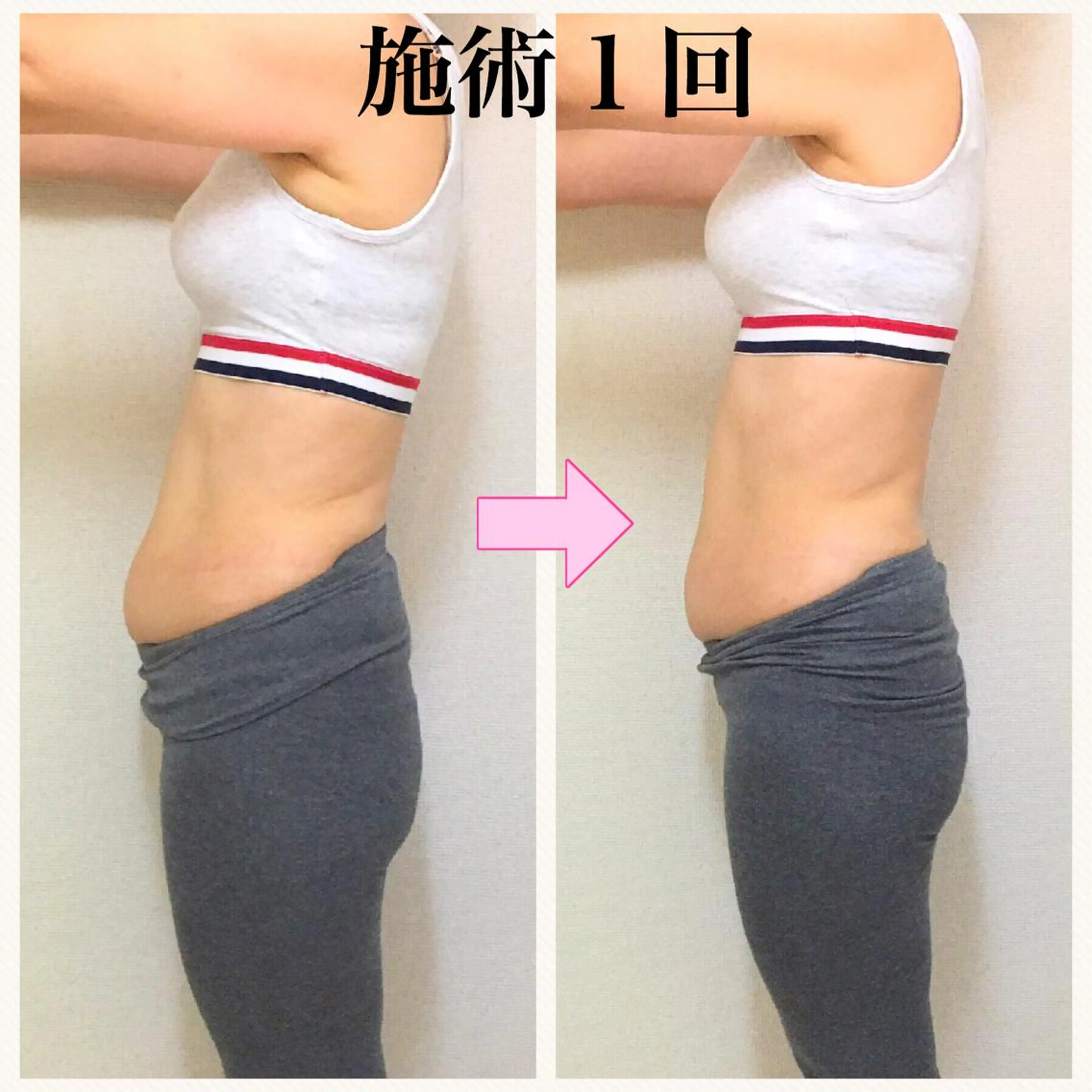 小顔モニター 募集のエステ・リラクイメージ