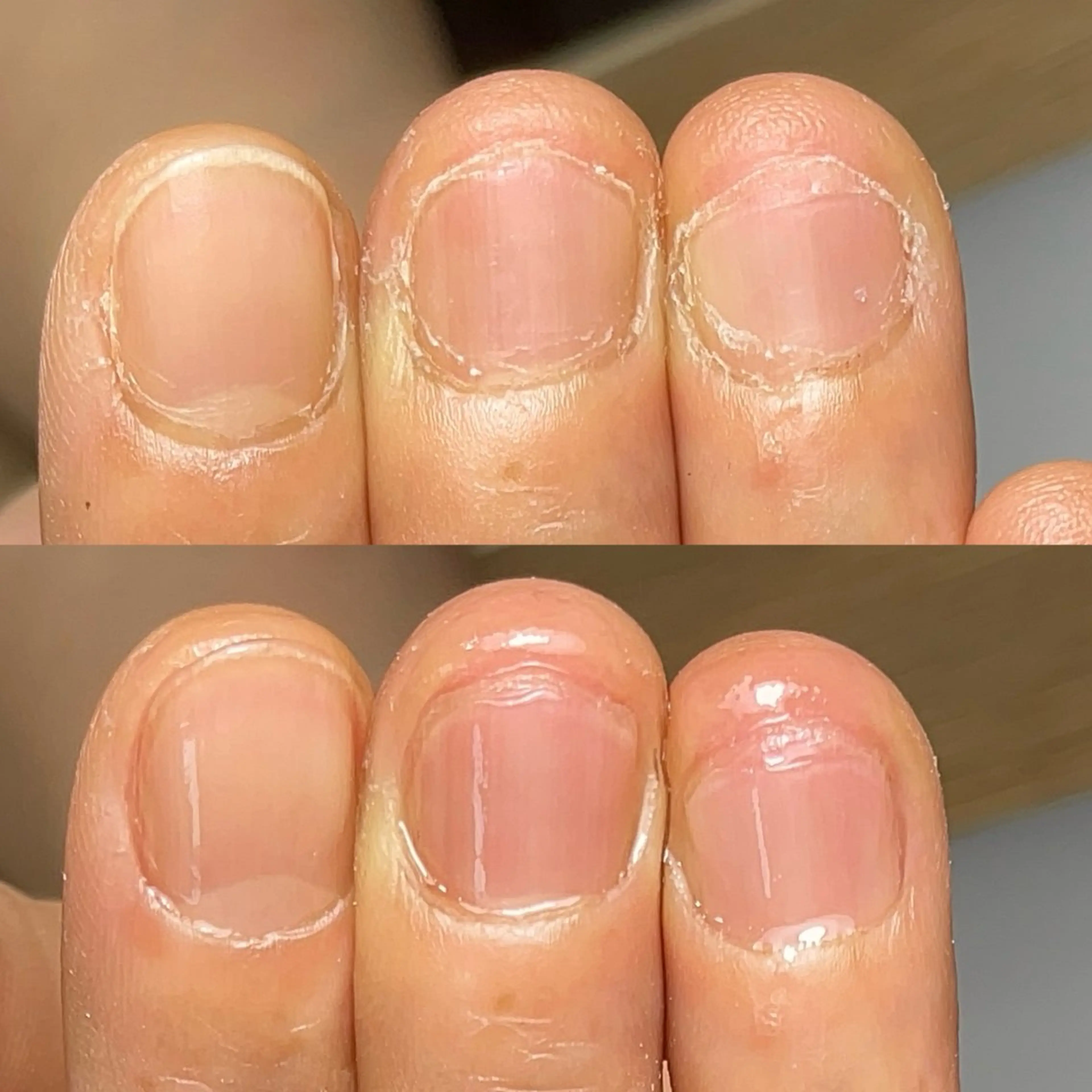 ネイル ジェルネイル Aim* 深爪・自爪育成専門店のネイルデザイン