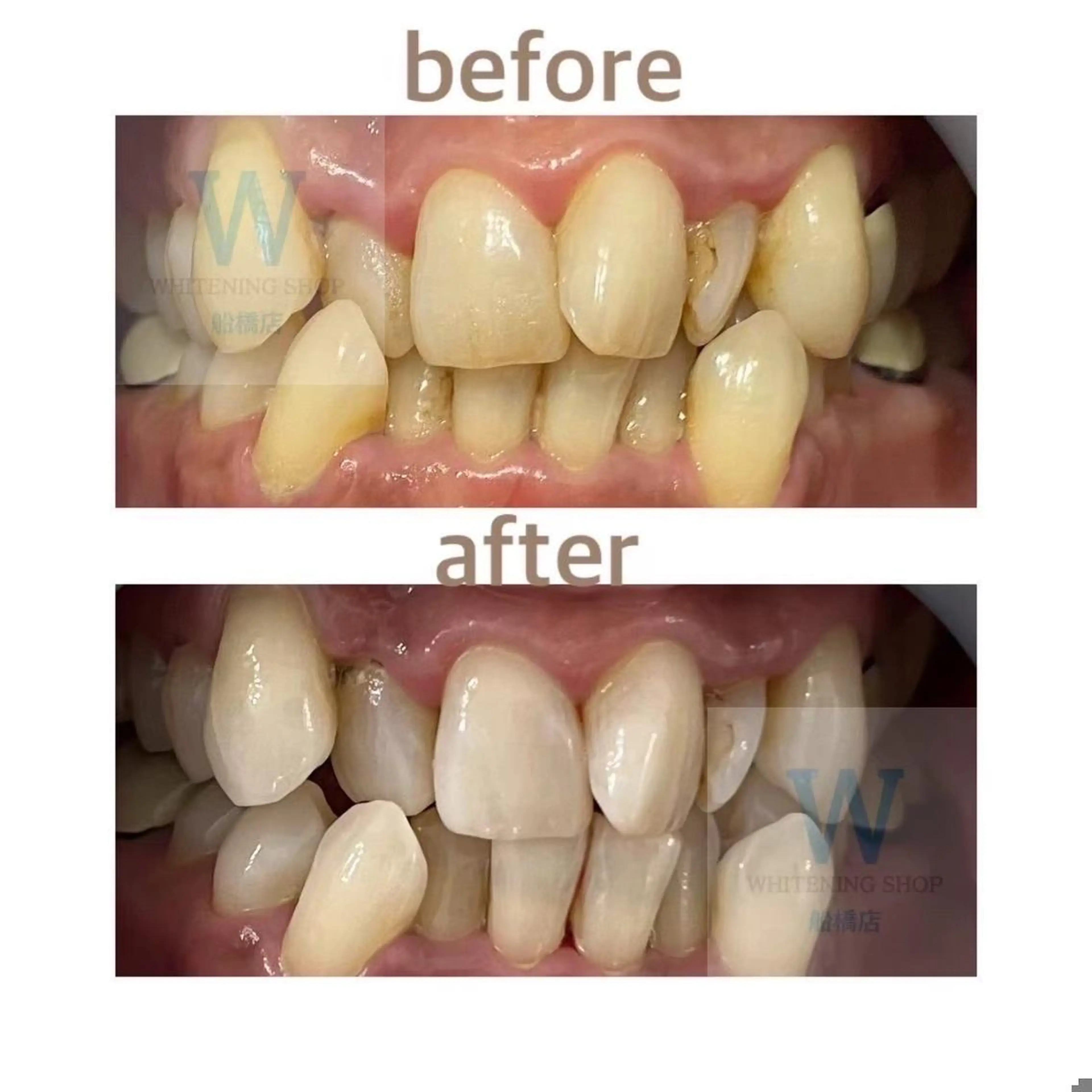 ホワイトニング ショップ船橋店🦷のエステ・リラクイメージ