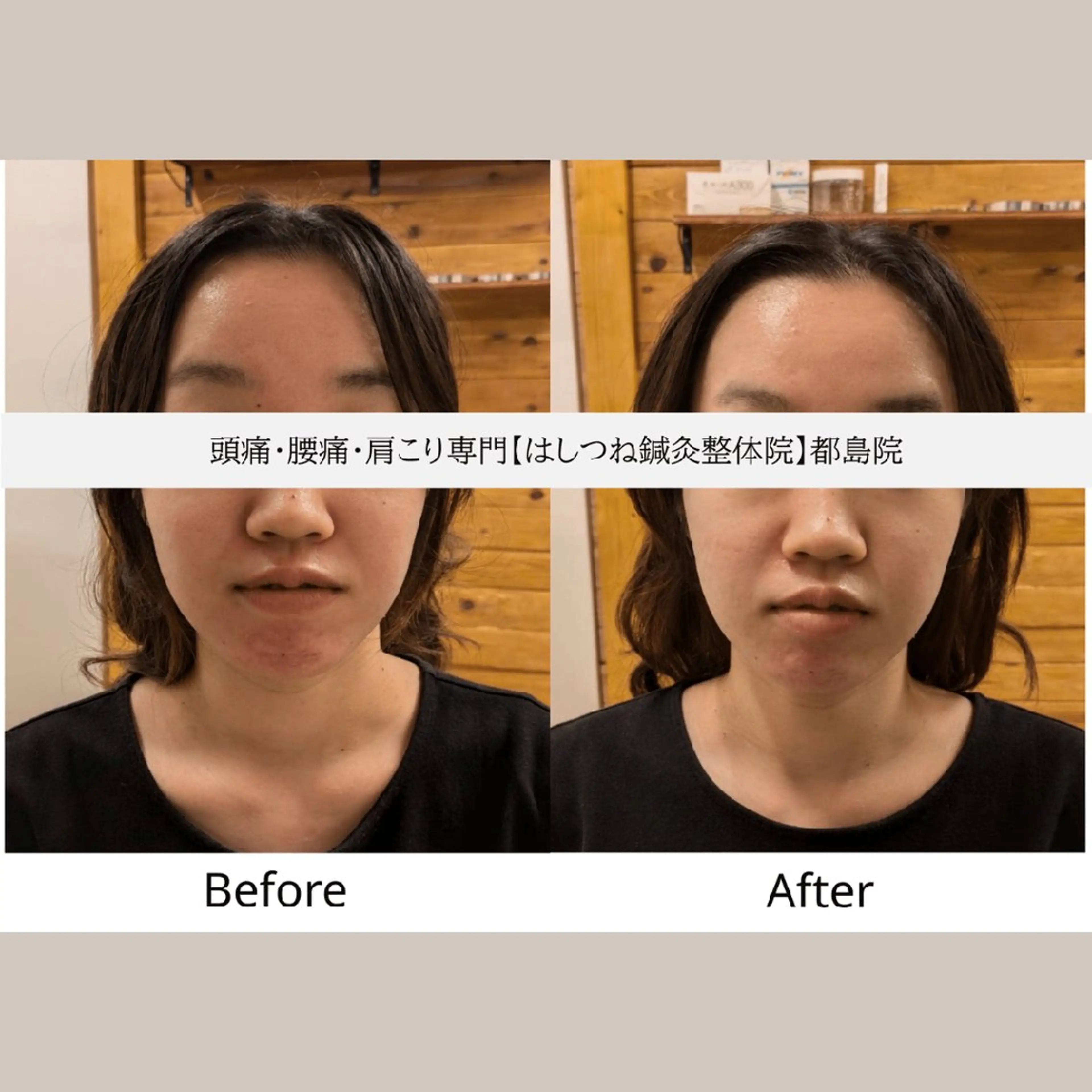 頭痛・腰痛・肩こり 特化してます。　橋岡のエステ・リラクイメージ