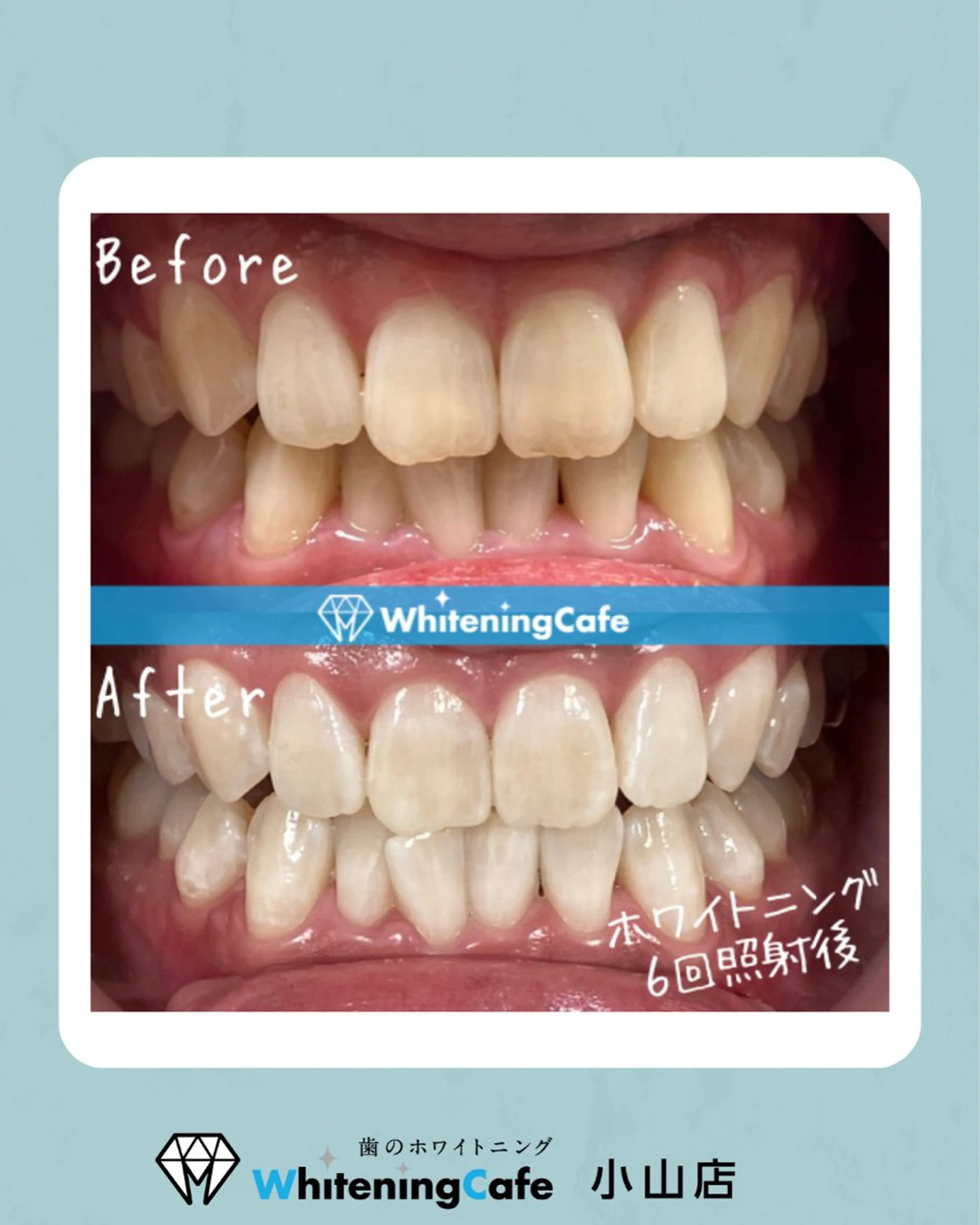 ホワイトニングカフェ 小山店のエステ・リラクイメージ