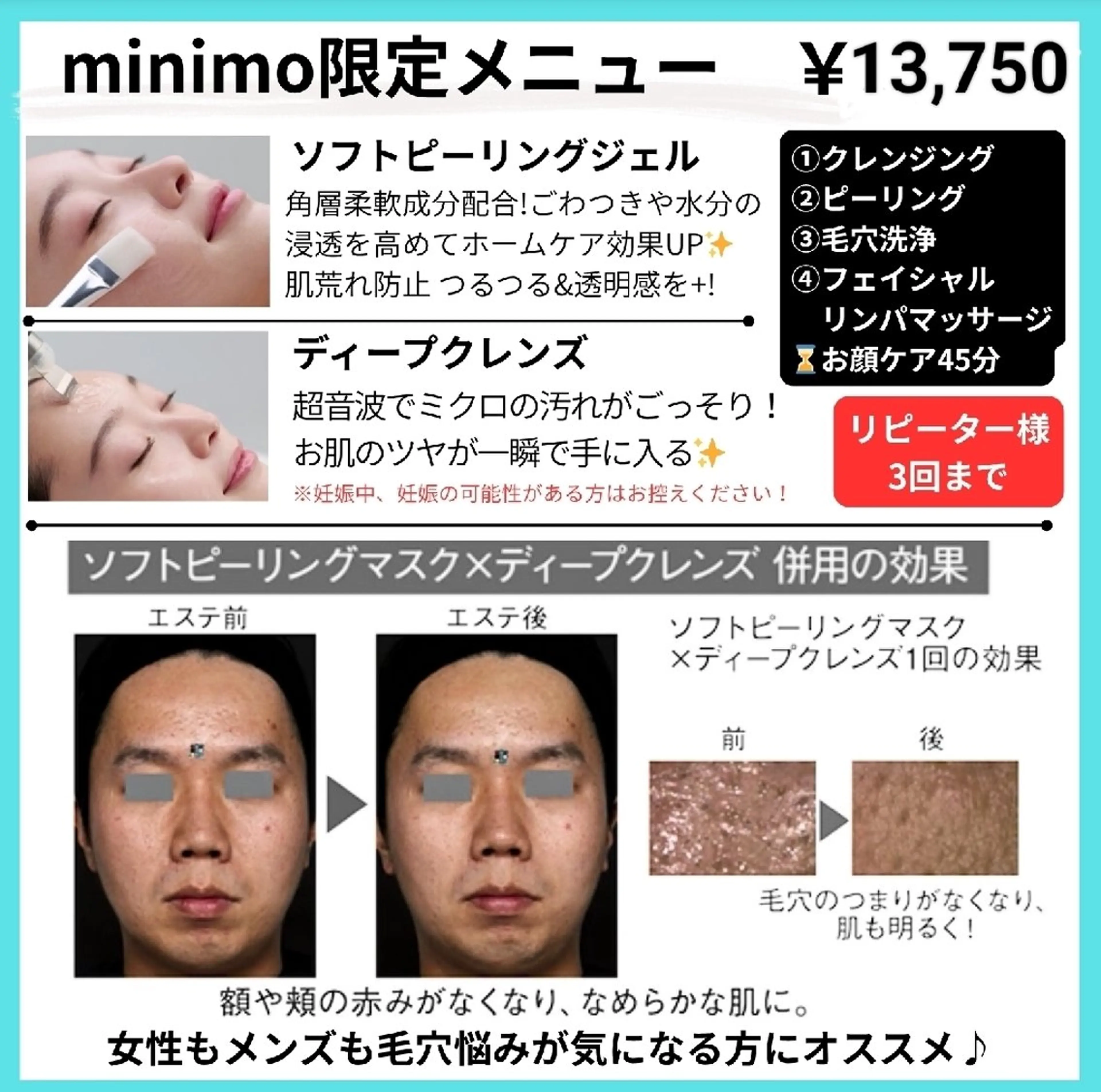 【メンズ限定】洗顔3ヶ月分付き♪毛穴洗浄フェイシャルコース🫧の写真