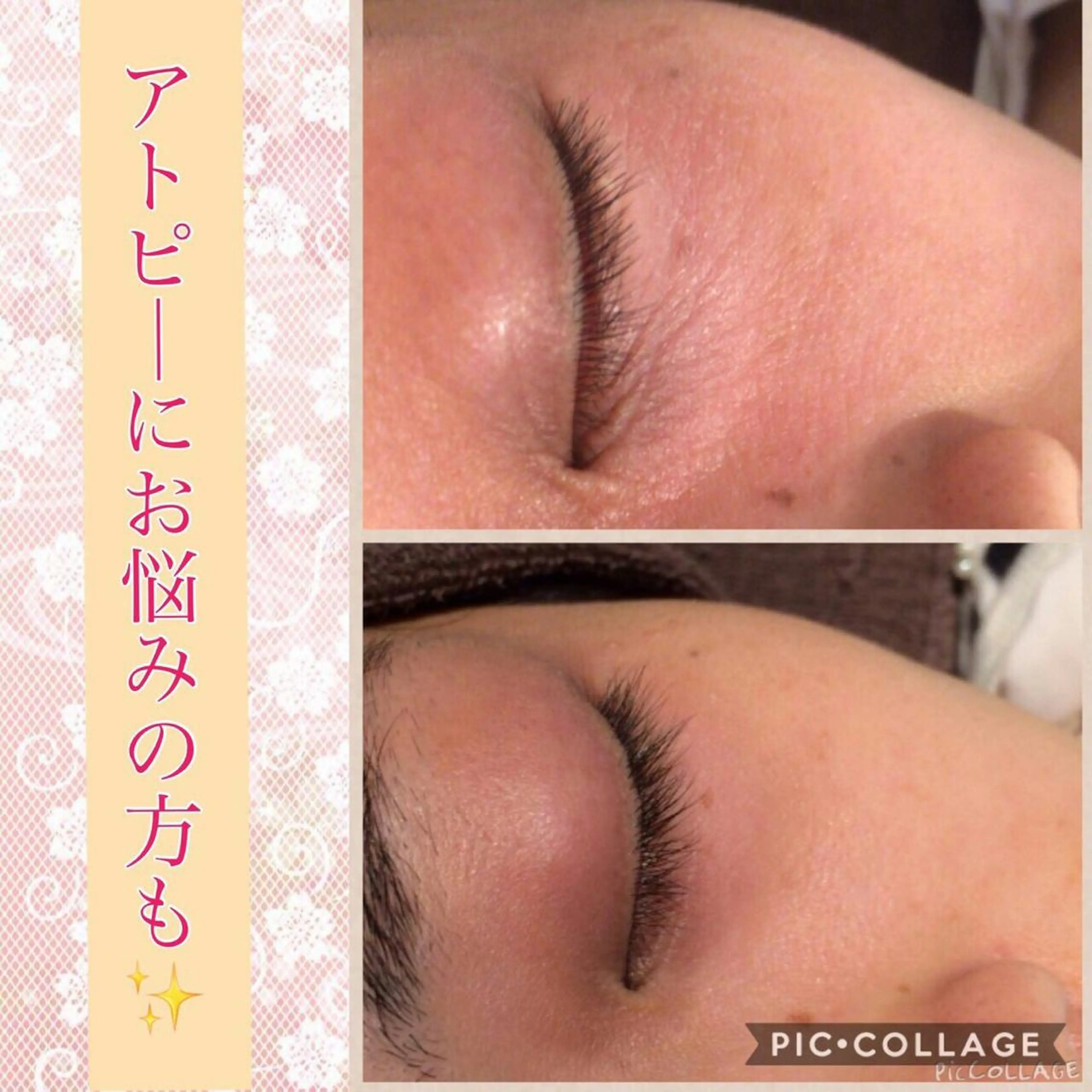 ショート カラー パーマ ヘアアレンジ メンズ キッズ ネイル マツエク・マツパ ニキビ・肌質改善専門 ♡人生が変わるサロンのエステ・リラクイメージ