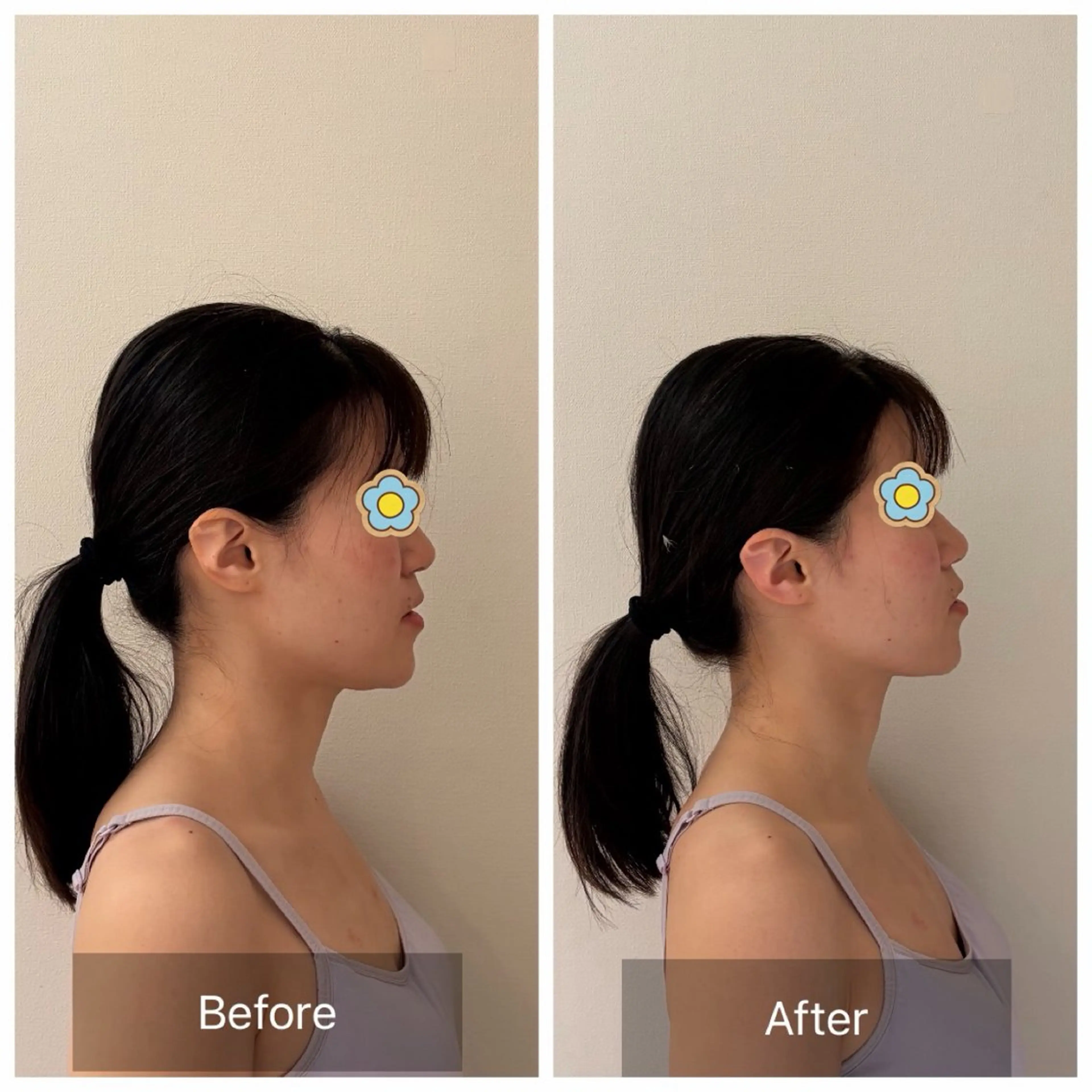 エステ リラク 勝山式美容矯正サロン　るりあん所属・山口 真由子のエステ・リラクイメージ