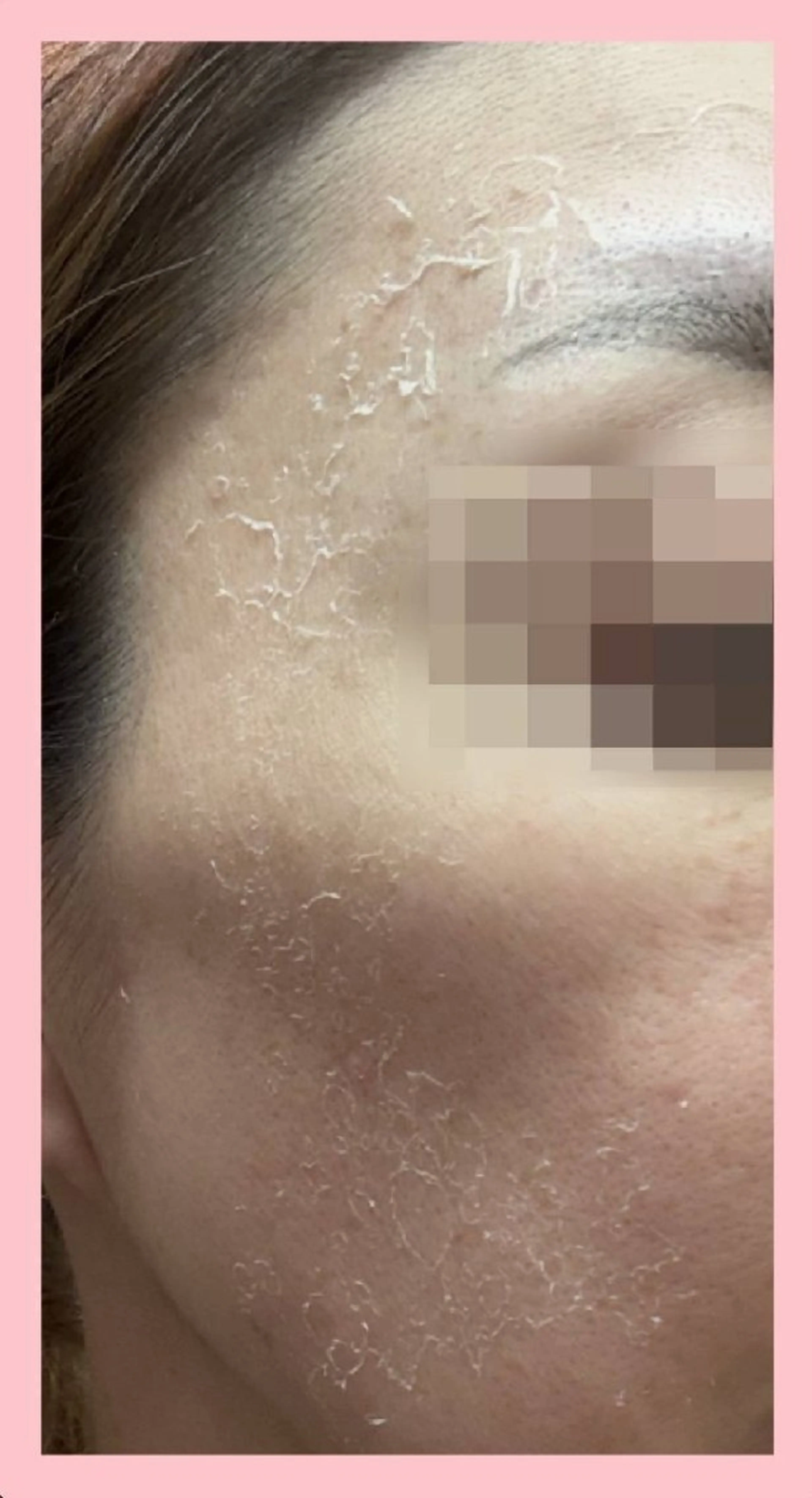 エステ ハーブピーリング 専門店Kikkaのエステ・リラクイメージ