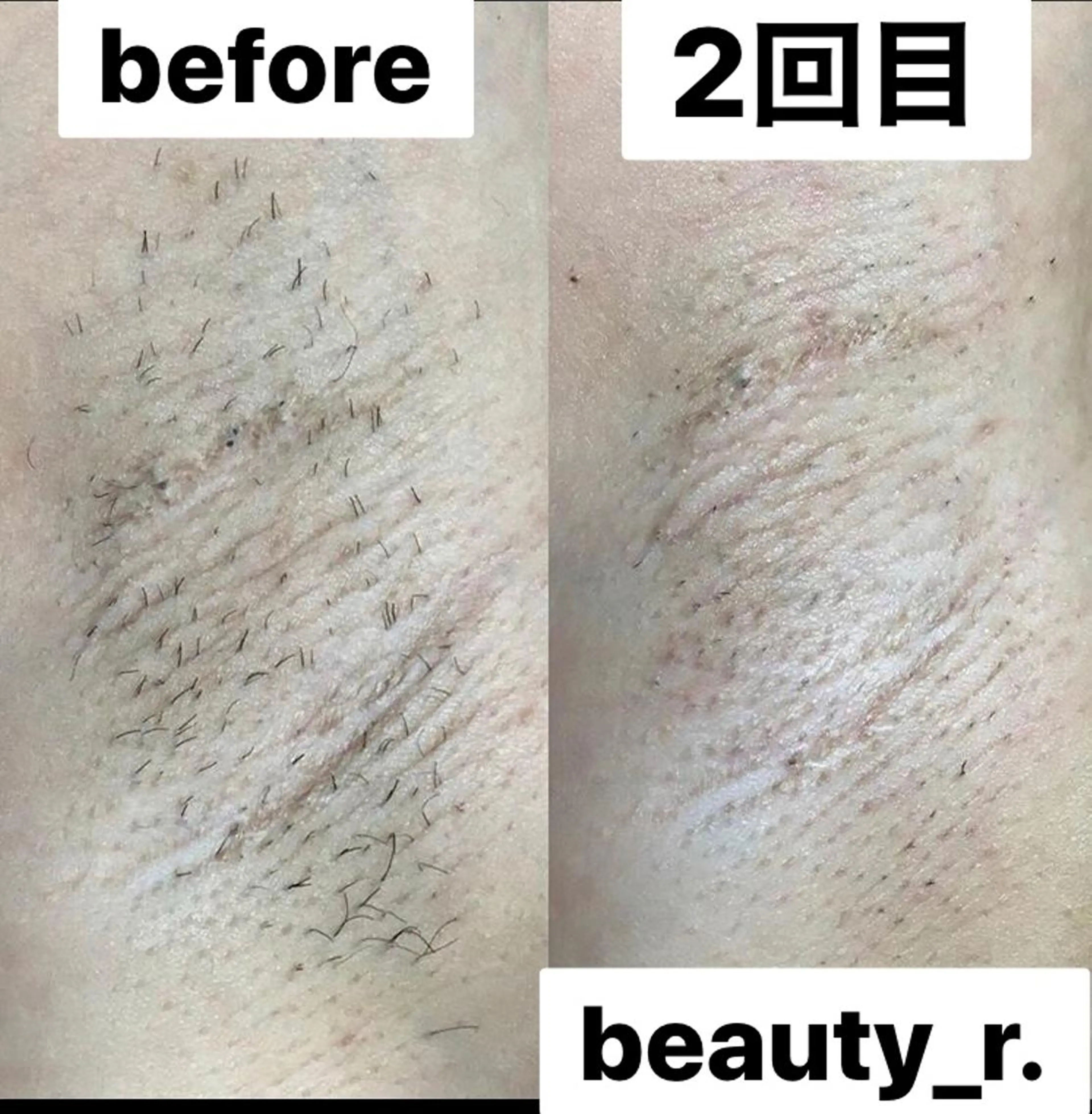 杉原 里奈のエステ・リラクイメージ