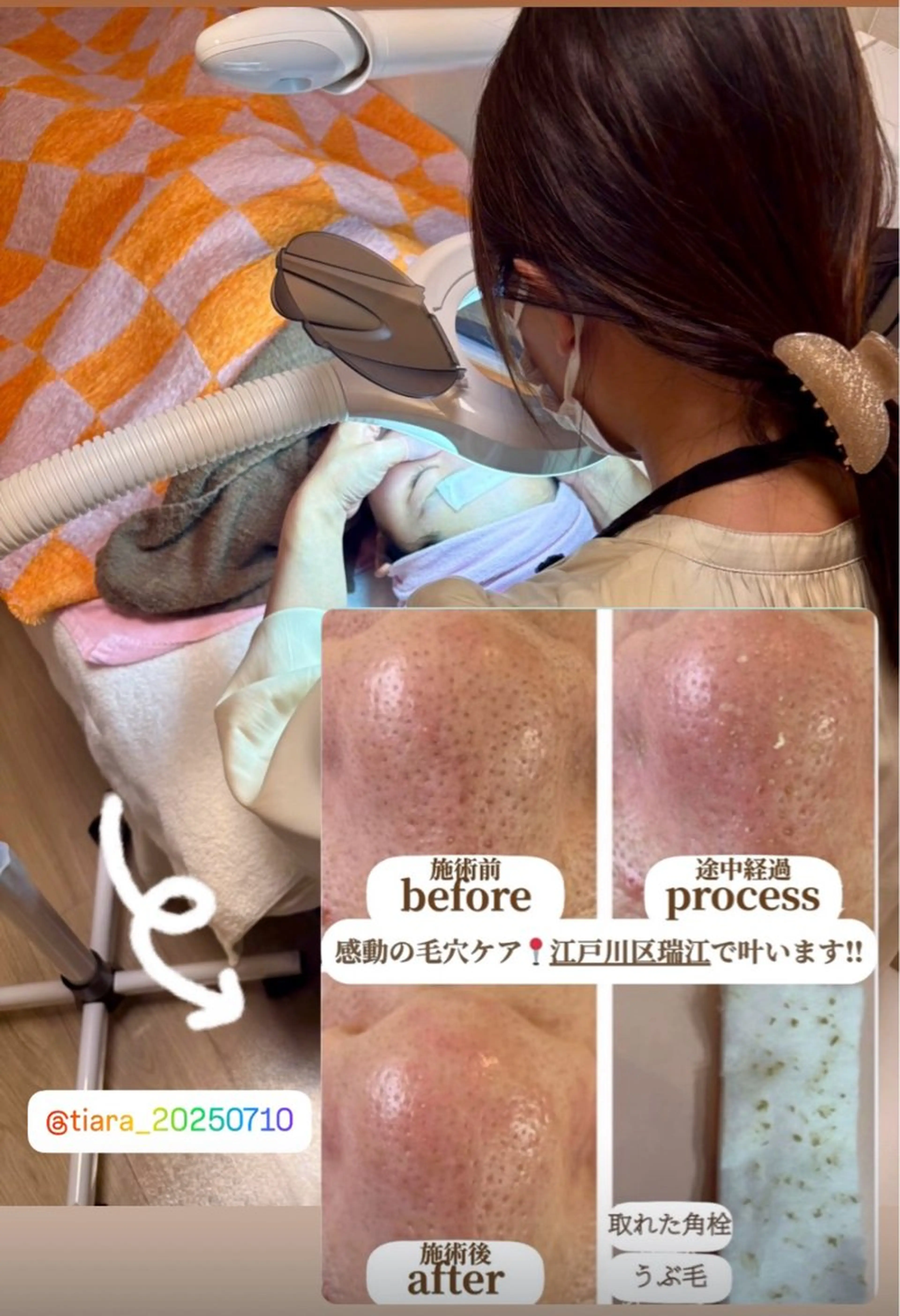 【毛穴専門店】 瑞江|yukaのエステ・リラクイメージ