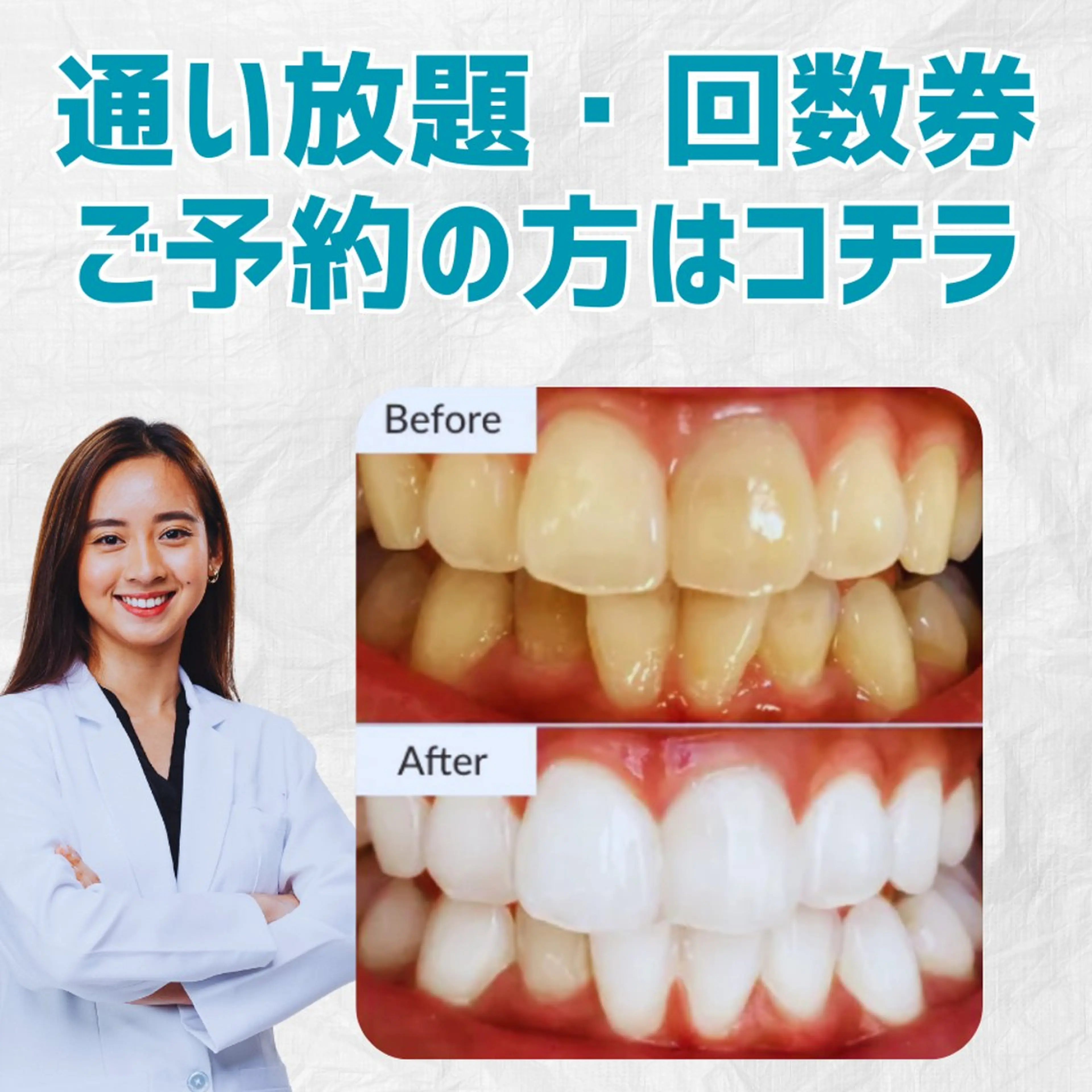 【1回4500円60分照射・回数券】お申込で医療提携ホワイトニング1回無料!の写真