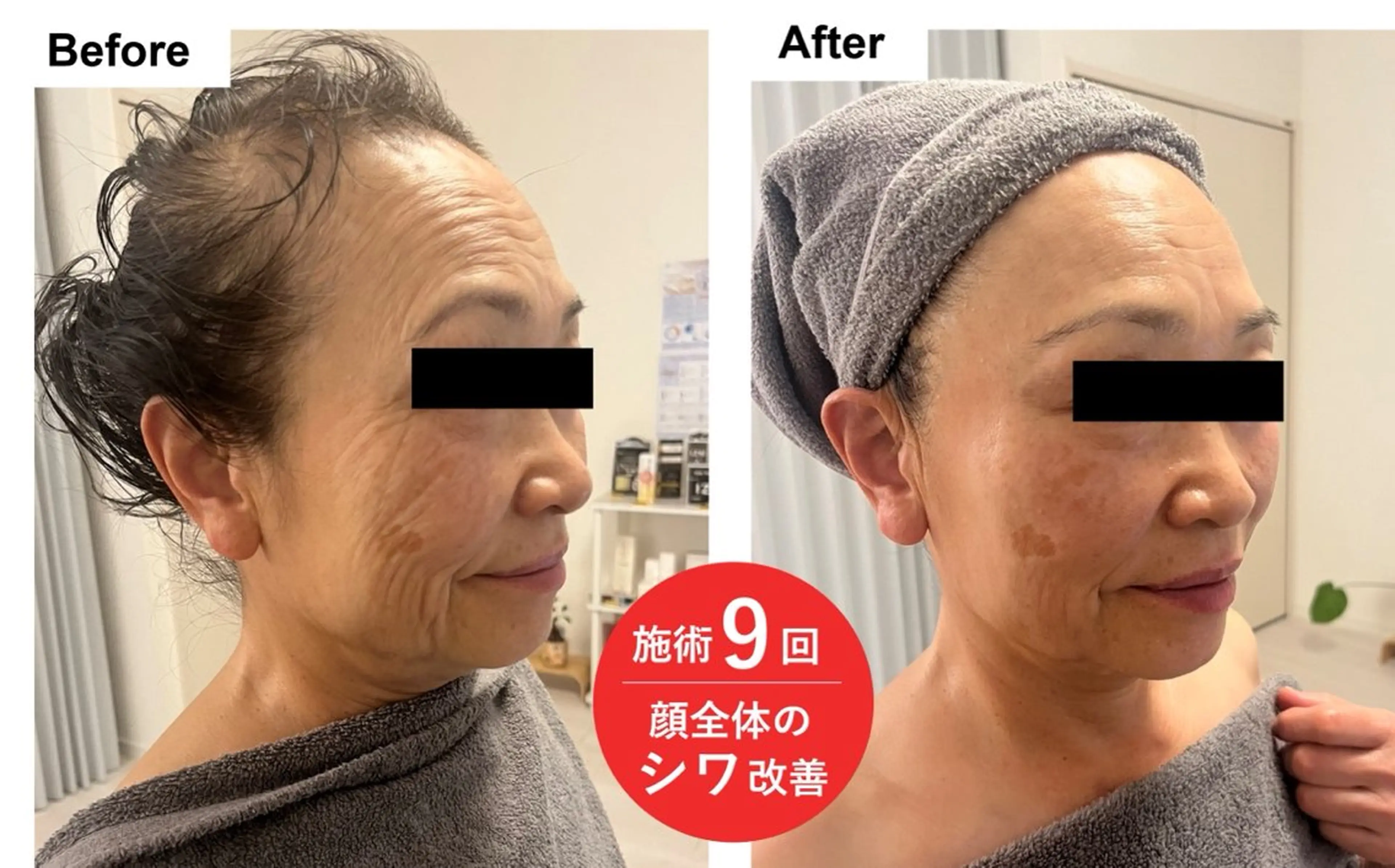 60分で-5歳肌✨プレミアムエステ🌸デコルテマッサージ付きの写真