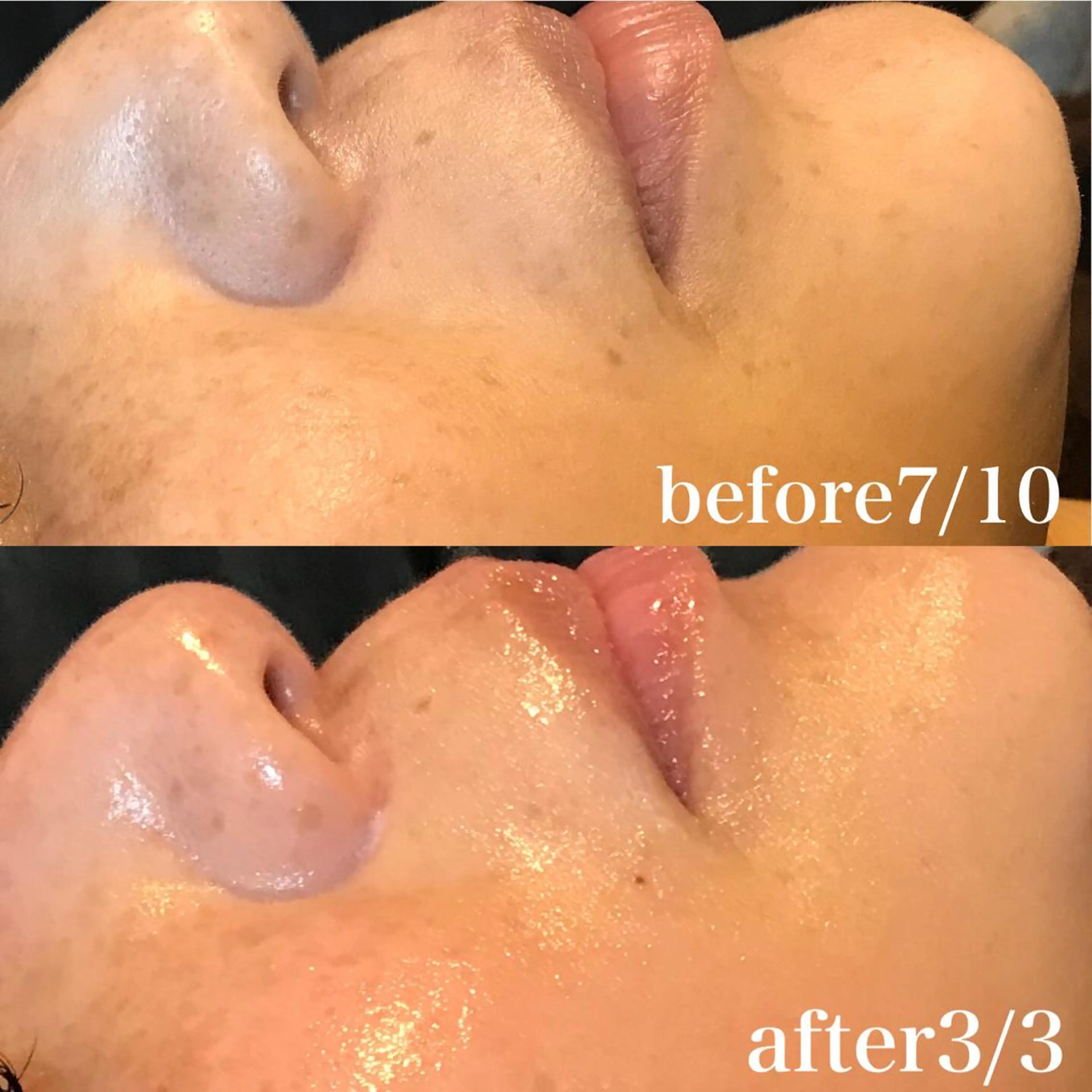 エステ 浜野 恵美のエステ・リラクイメージ