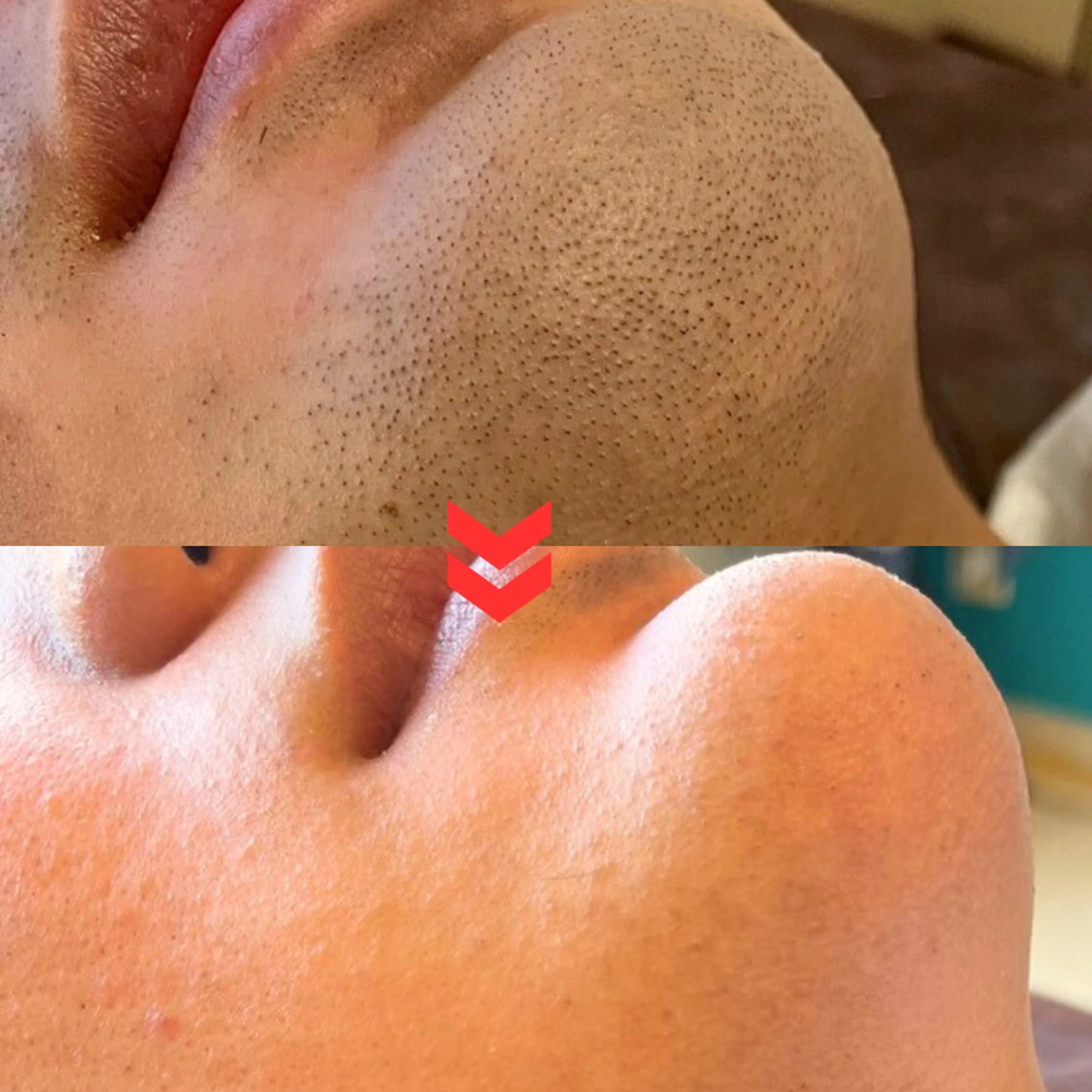 メンズ 【メンズ脱毛専門店】TODAY所属・都度払い制メンズ脱毛 オーナーのエステ・リラクイメージ