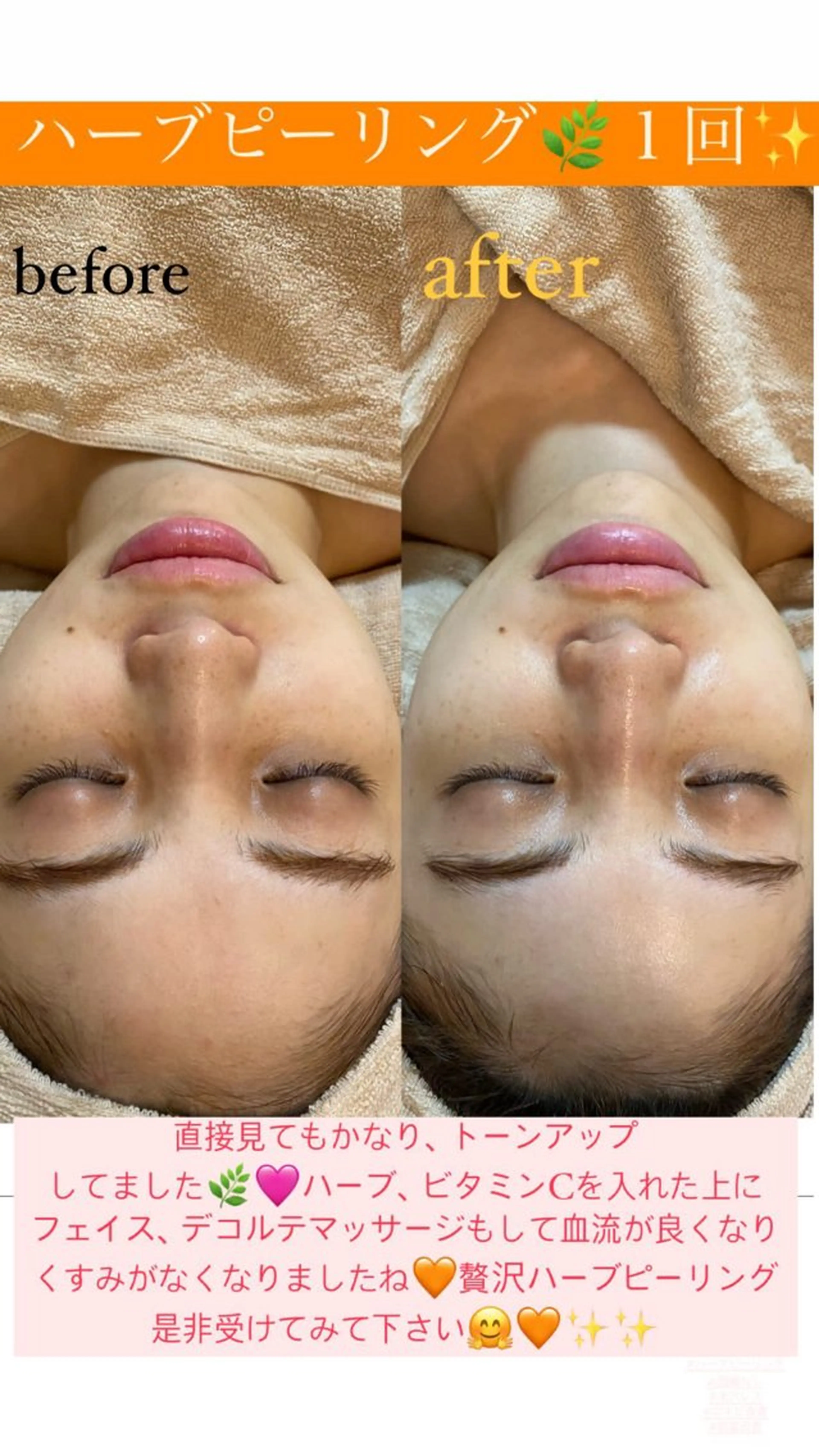 エステ Salon de Lino 御器所のエステ・リラクイメージ