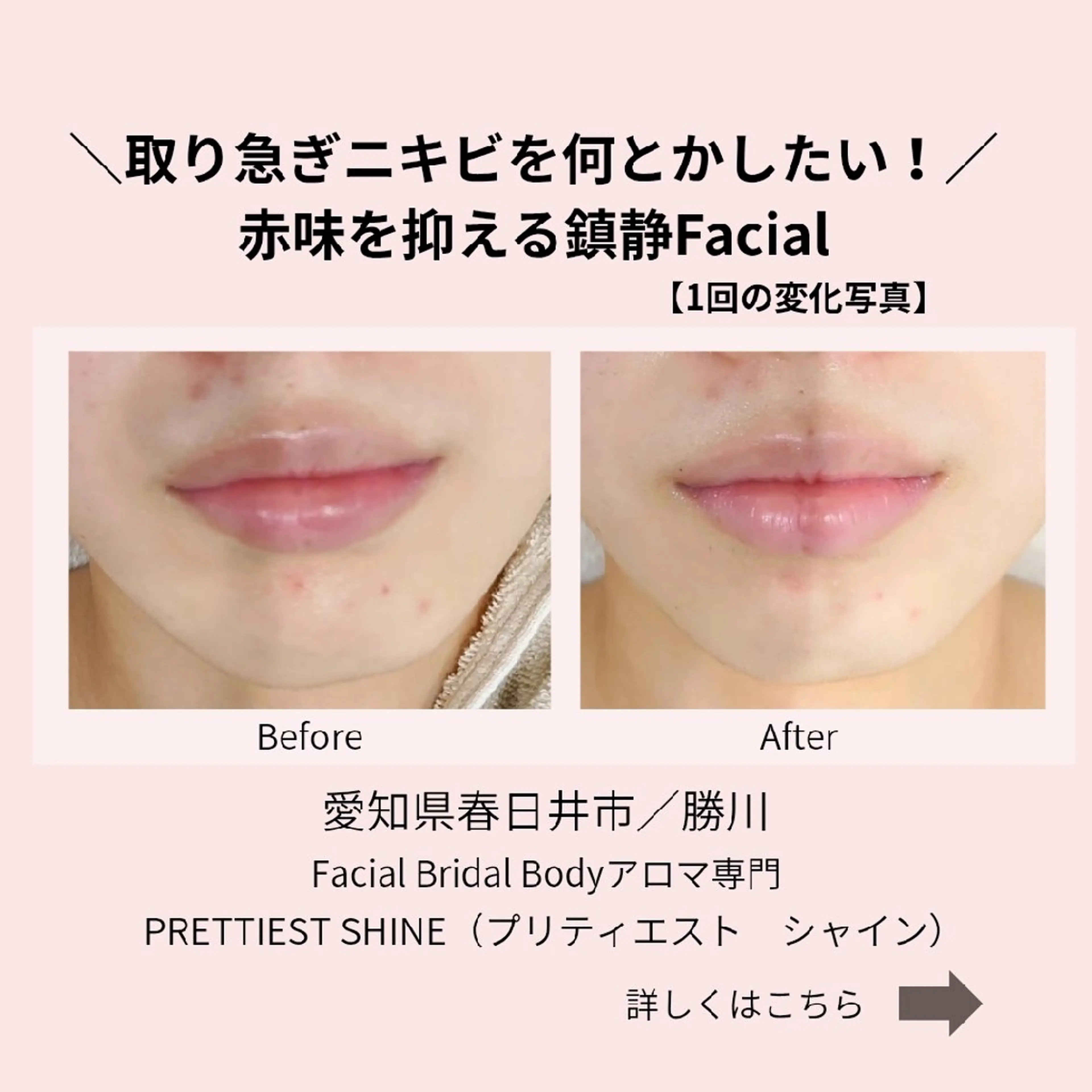 エステ PRETTIEST SHINE所属・山田 浩子のエステ・リラクイメージ