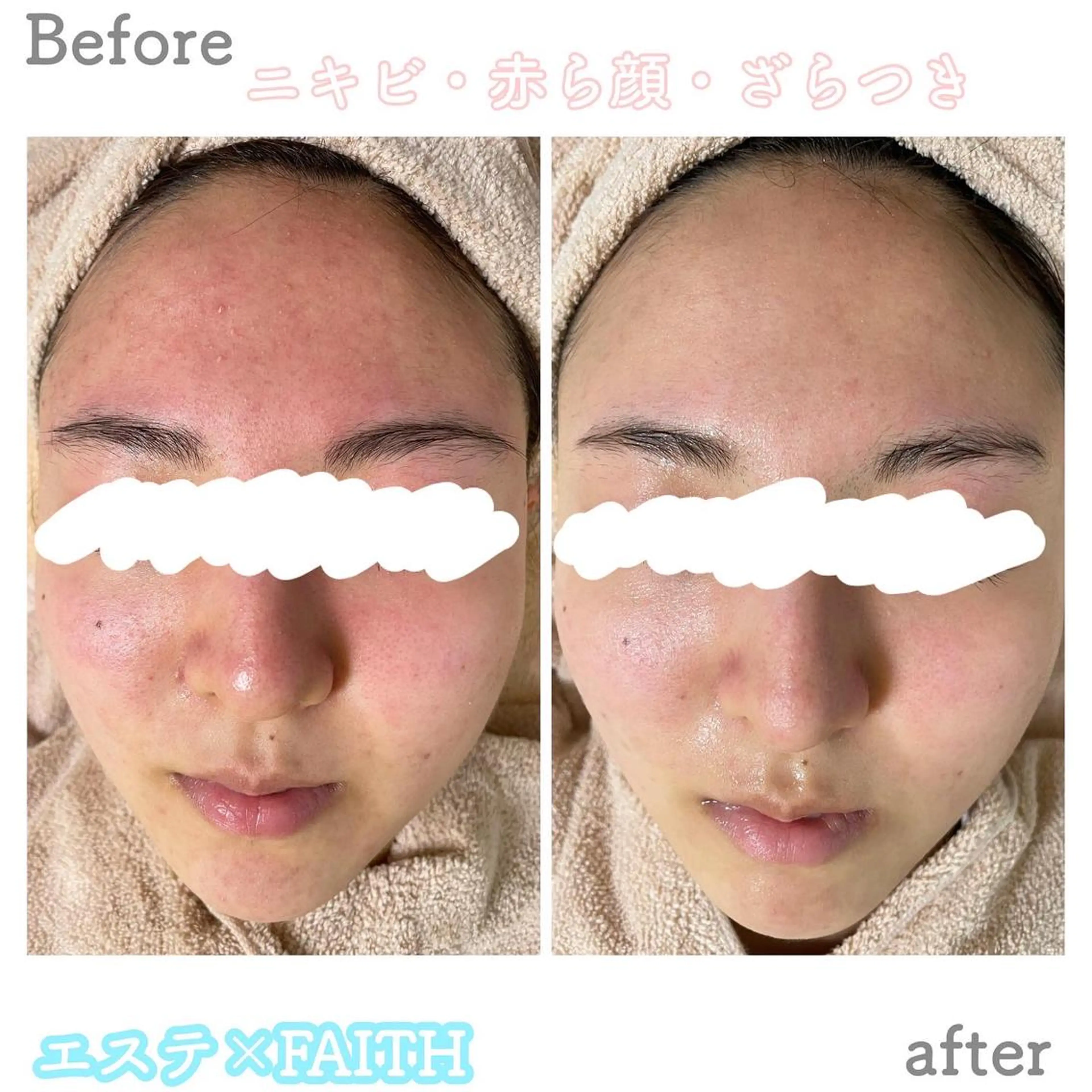 ショート カラー パーマ ヘアアレンジ メンズ キッズ ネイル マツエク・マツパ アイブロウ 赤色 エステ ニキビ&跡改善サロン オーナー光木のエステ・リラクイメージ