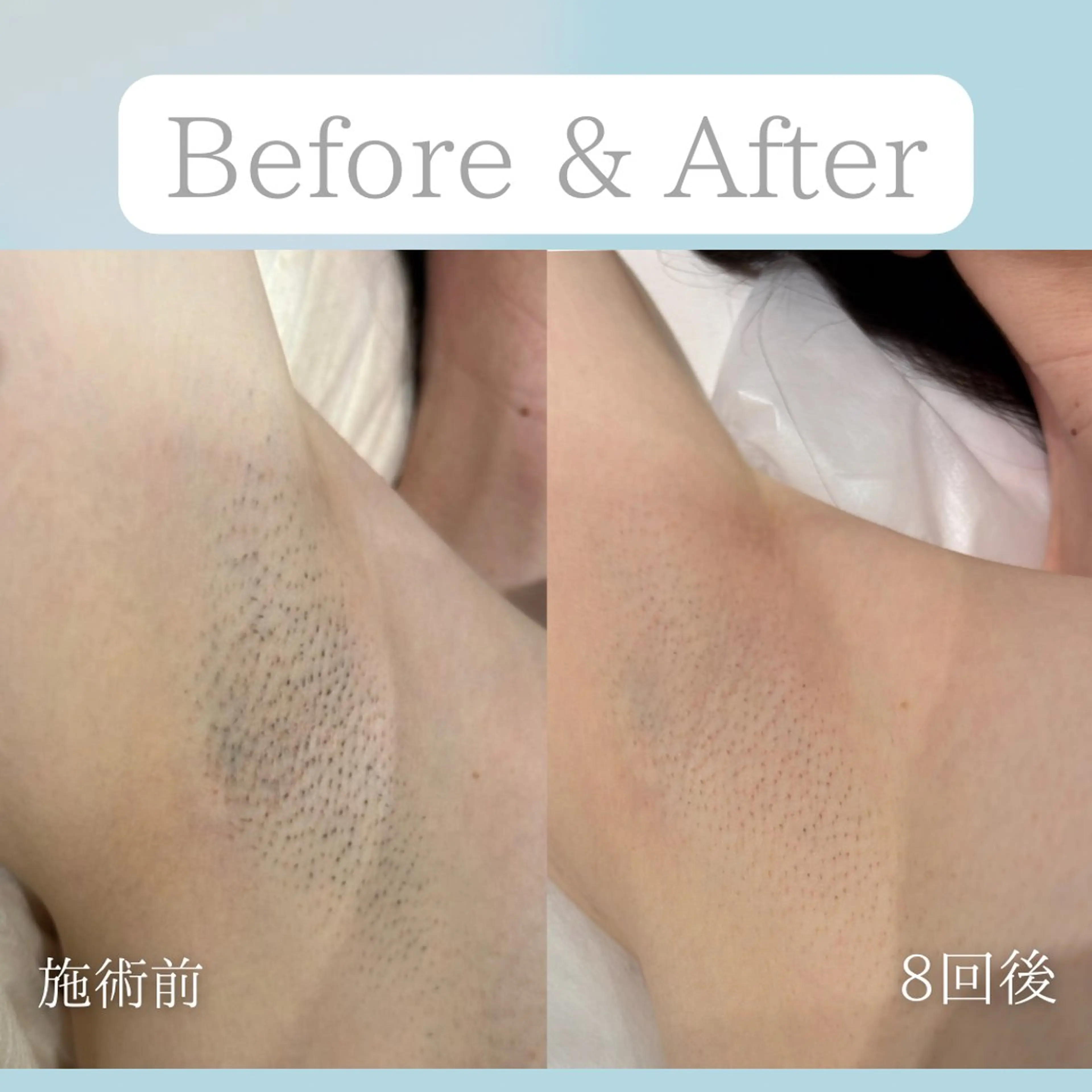 美肌脱毛&毛穴専門 Nico🐰ྀི♡のエステ・リラクイメージ