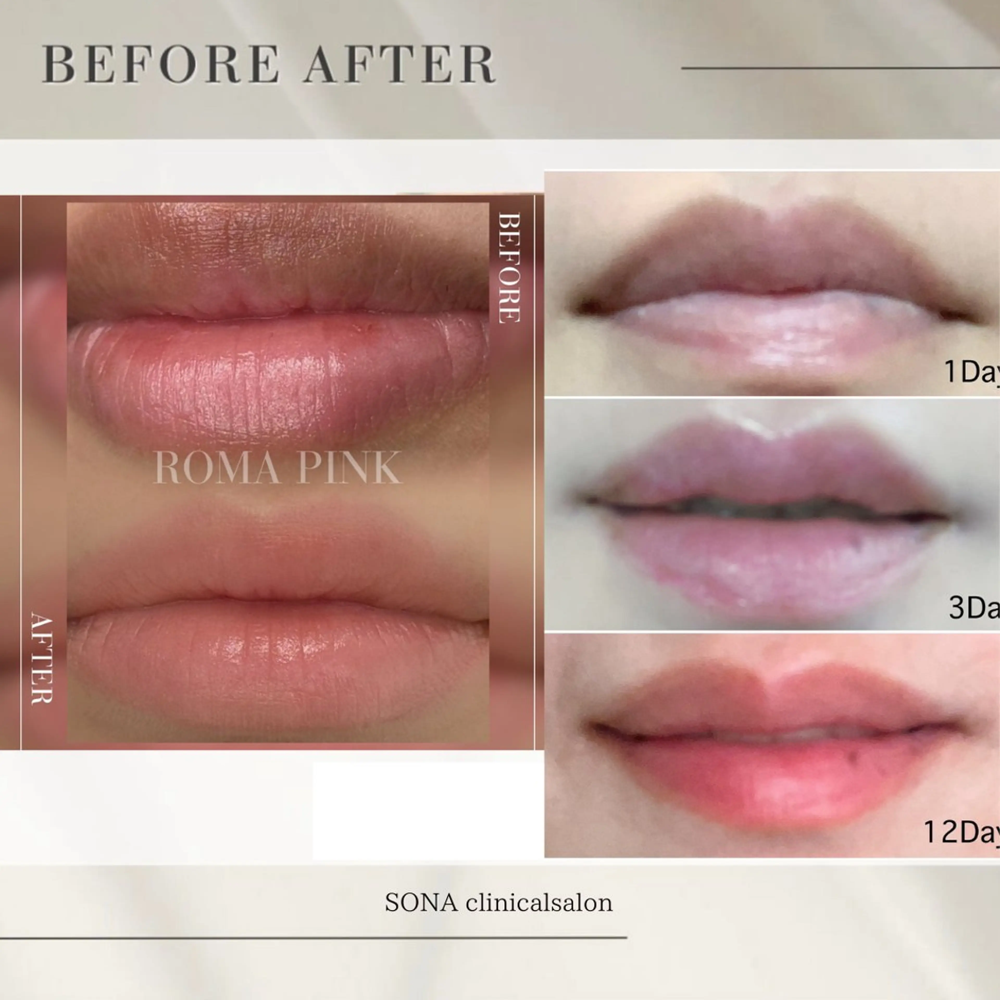 小顔/たるみ/黒ずみ除去専門サロン/SONA 大和西大寺店所属・【小顔専門看護師 サロンSONA】のエステ・リラクイメージ