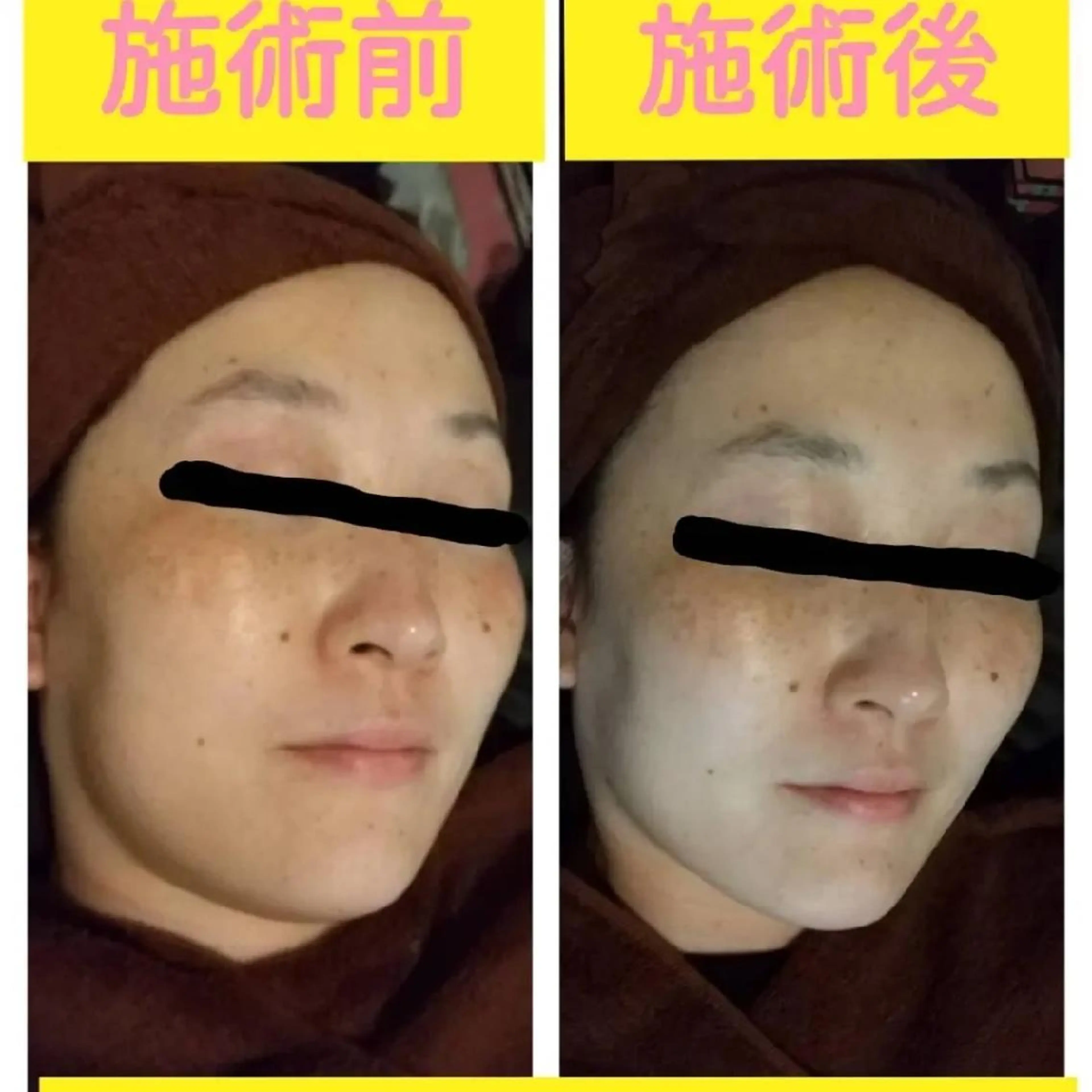 viage所属・viage 脱毛&フェイシャル店のエステ・リラクイメージ