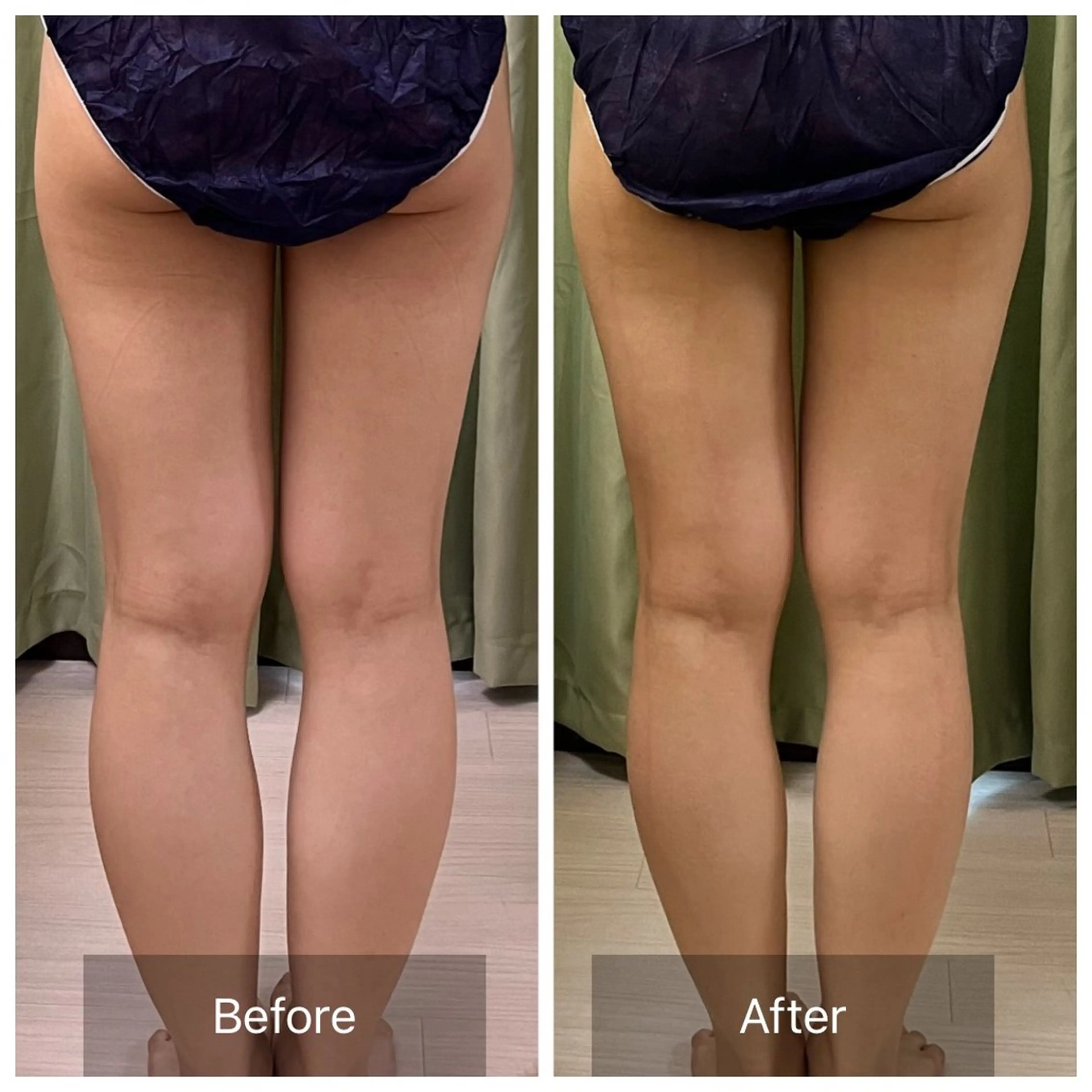 【元に戻らない】 小顔&部分痩せのその他イメージ