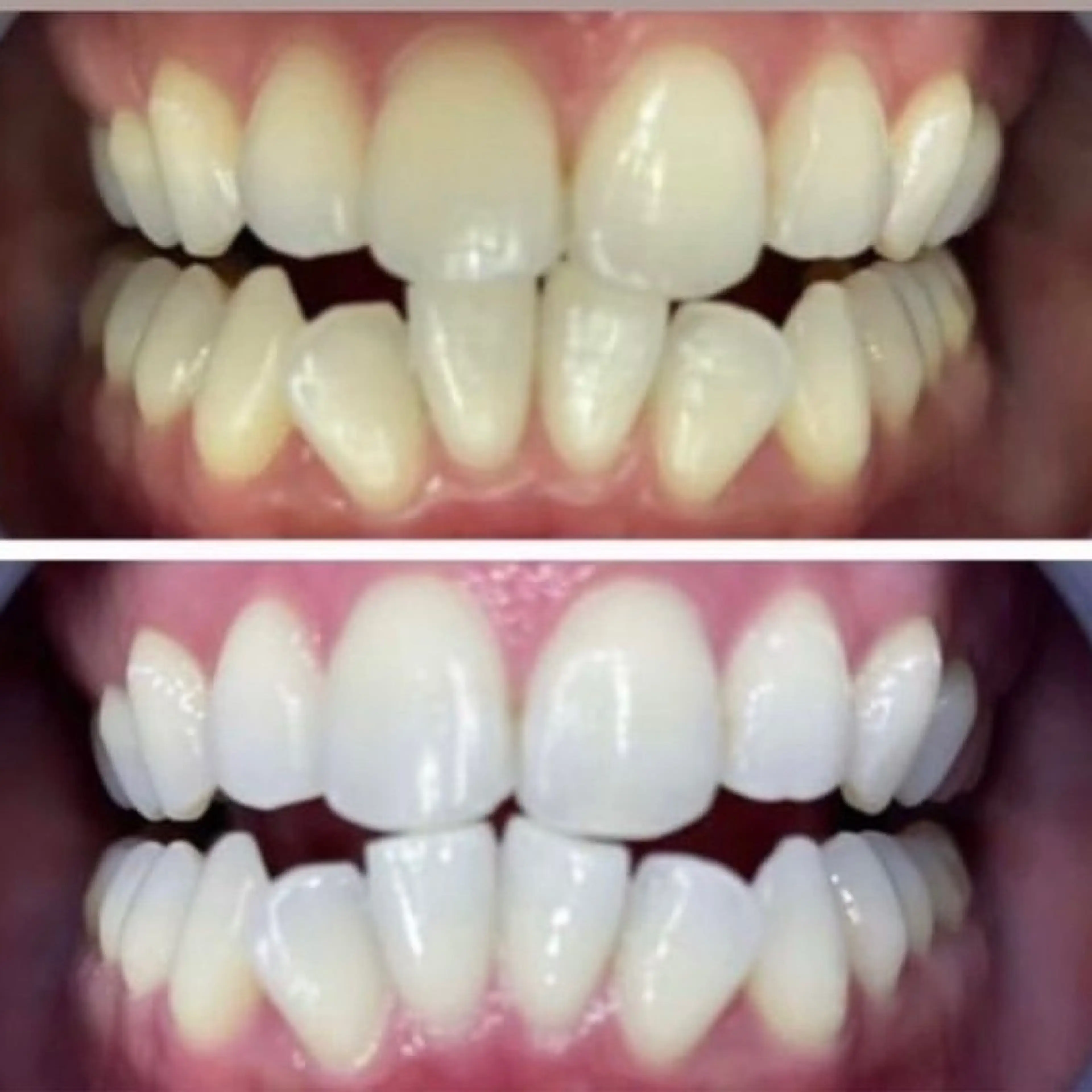 その他 LOVE ホワイトニング新宿店のエステ・リラクイメージ