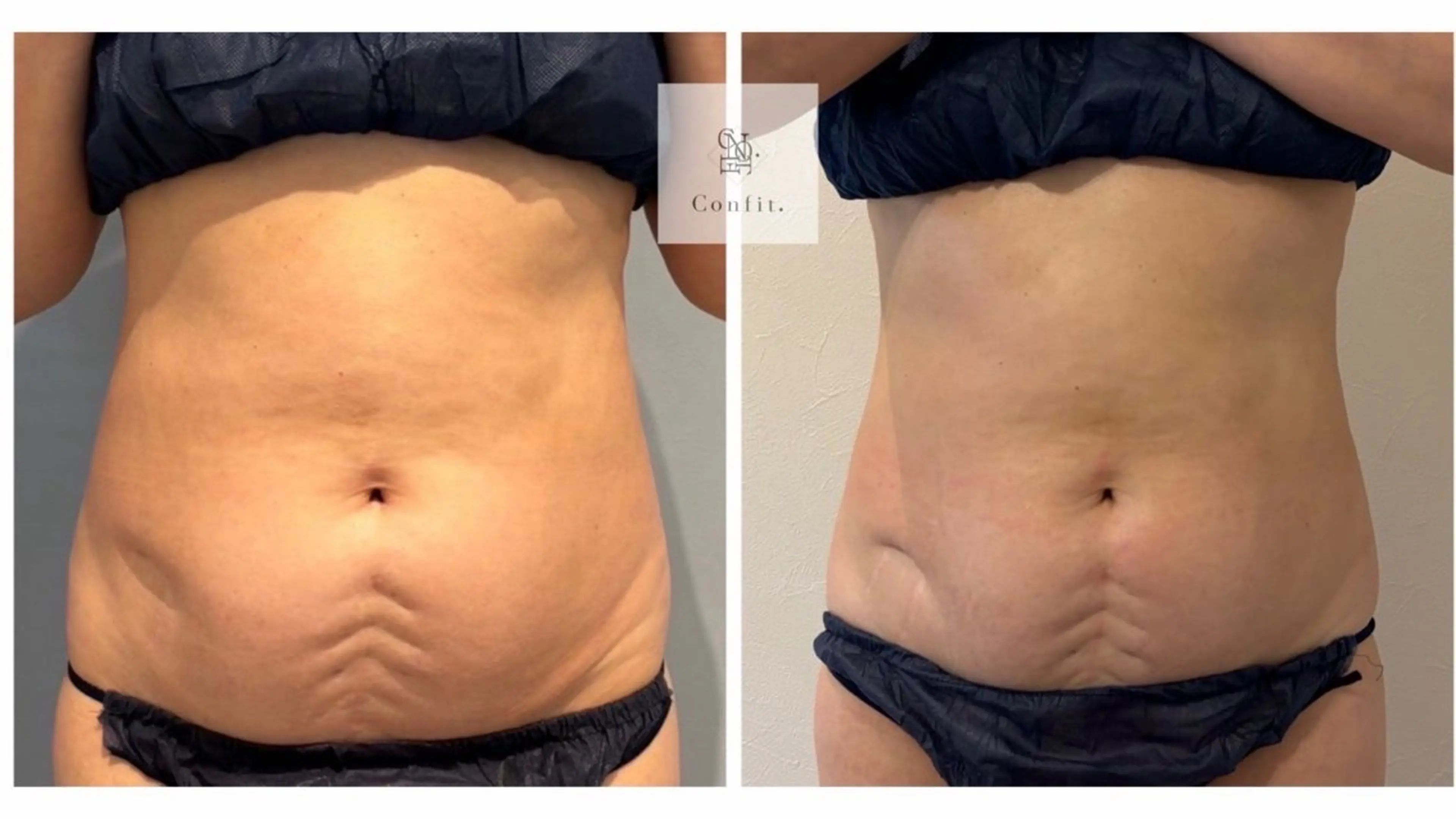 エステ 小顔/たるみ/黒ずみ除去専門サロン/SONA 大和西大寺店所属・【小顔痩身専門看護師 サロンSONA】のエステ・リラクイメージ