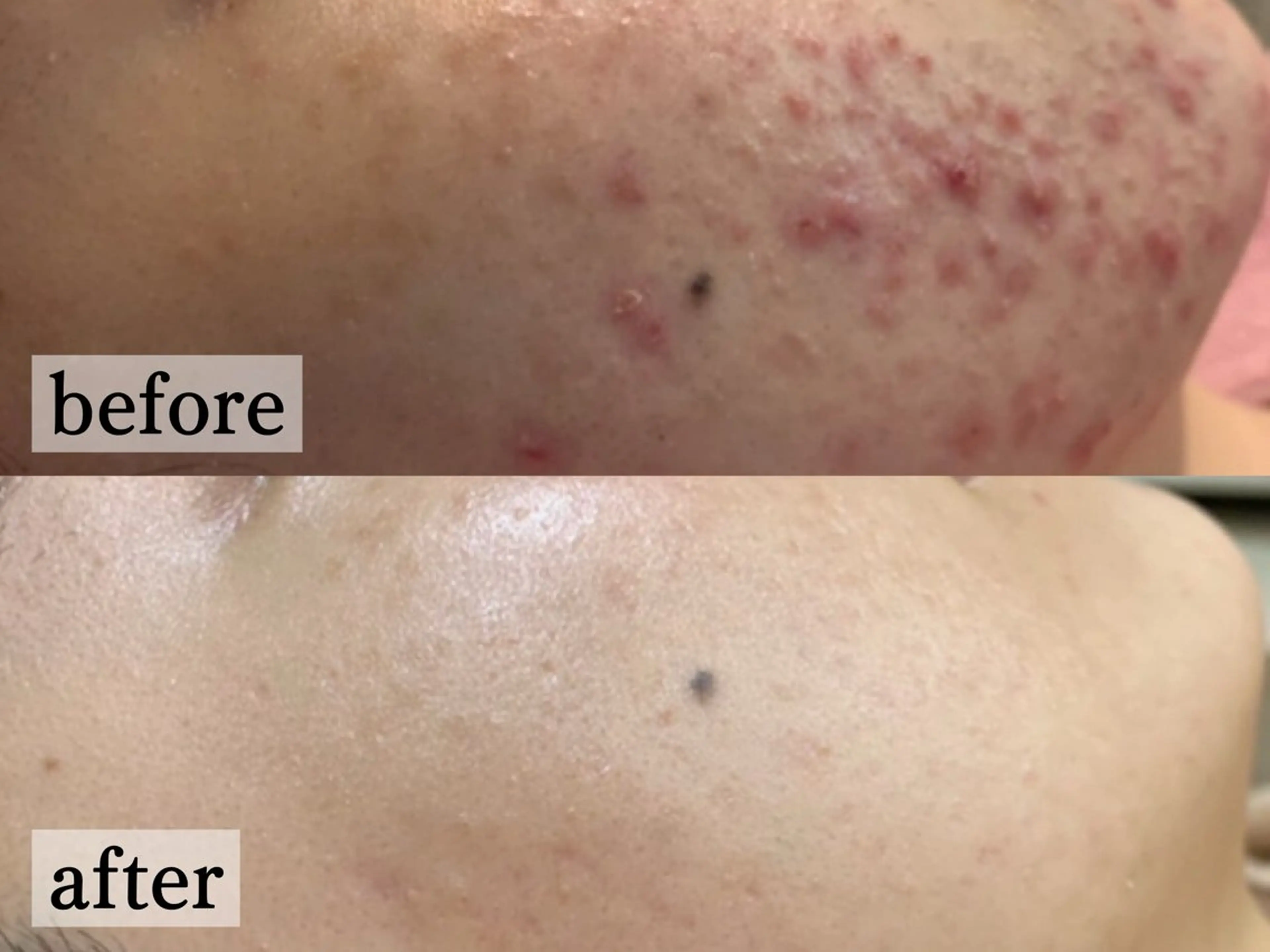 エステ フェイシャル/脱毛 ジョアアンジェ竹田のエステ・リラクイメージ