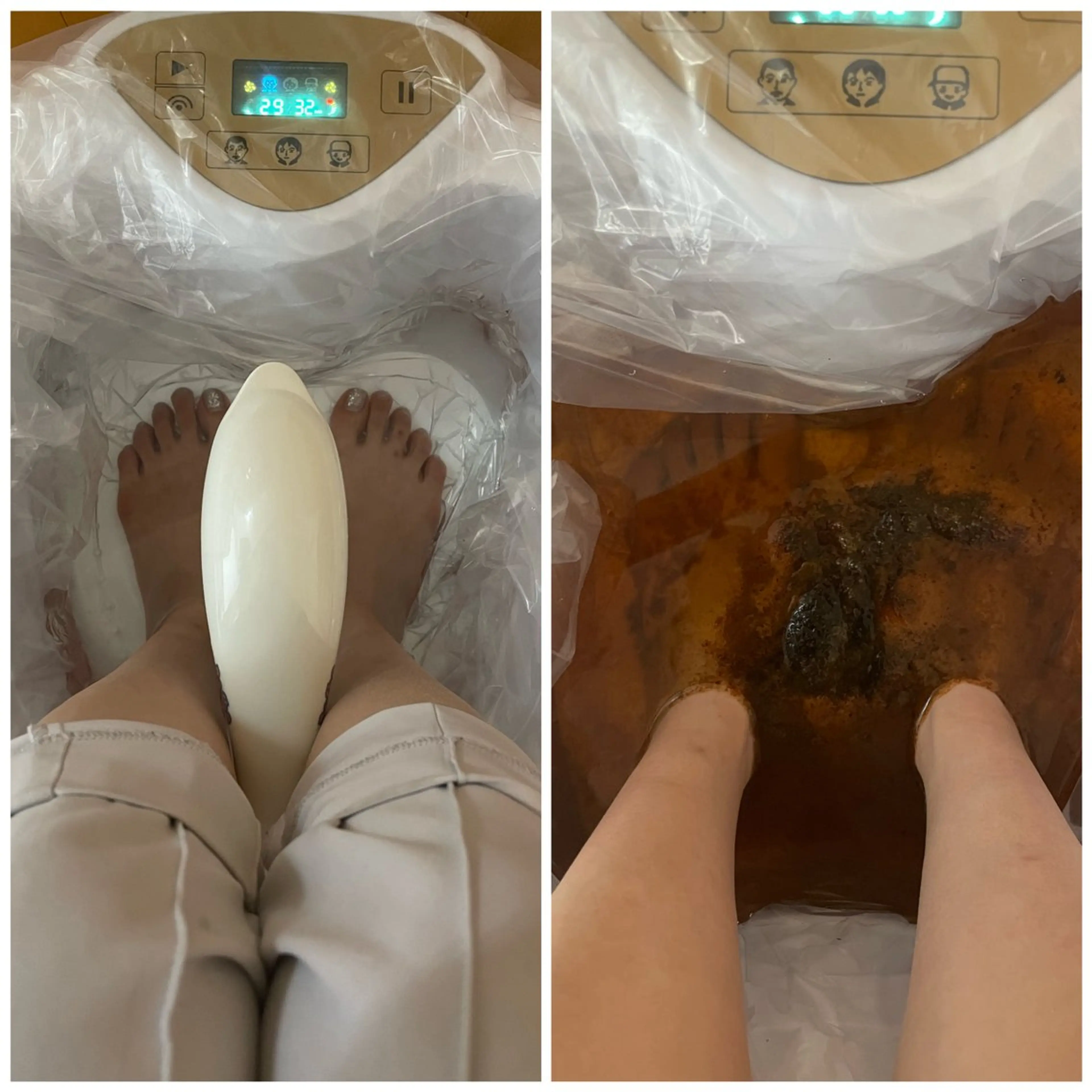 足湯デトックスの写真