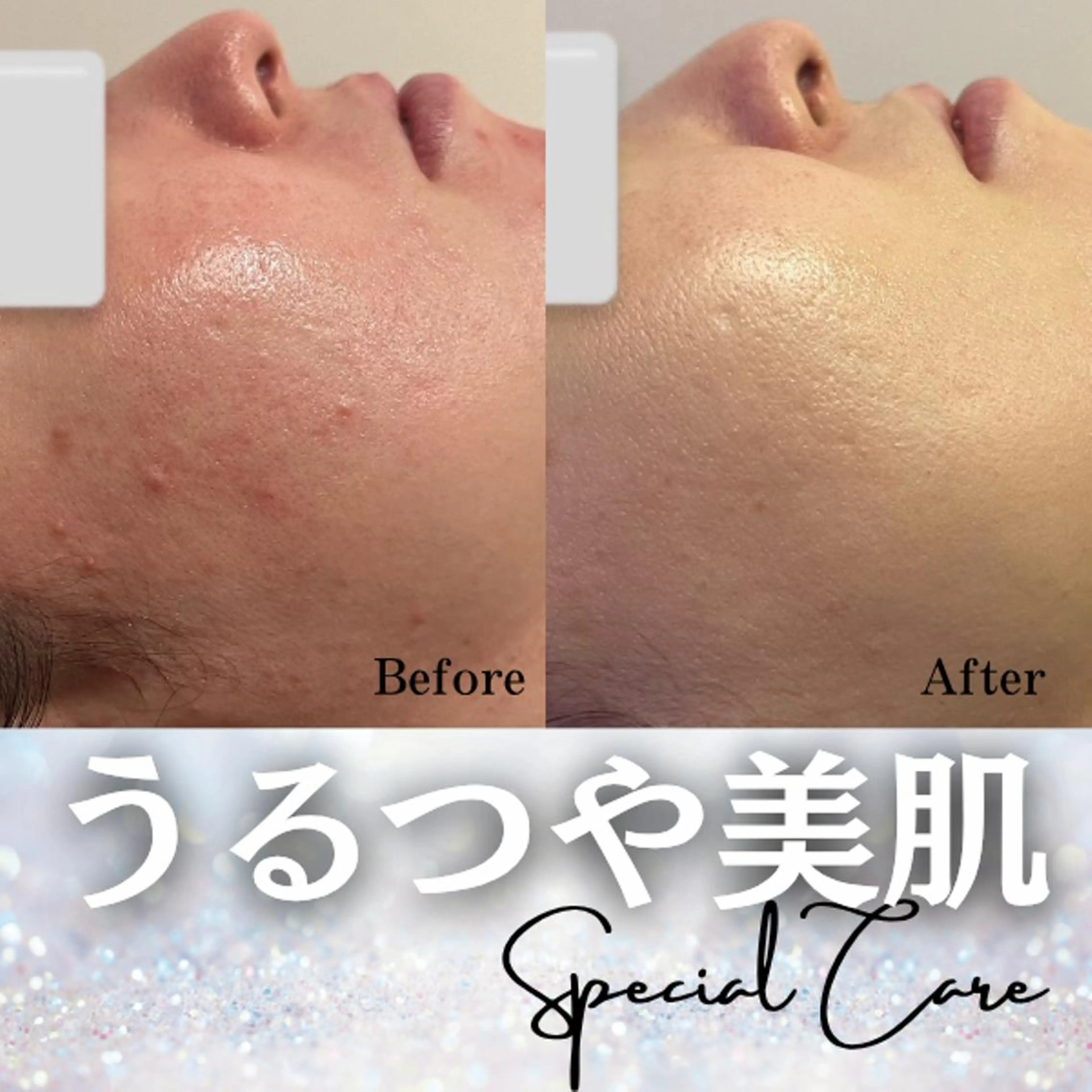 毛穴専門店Bebe 蘭のエステ・リラクイメージ