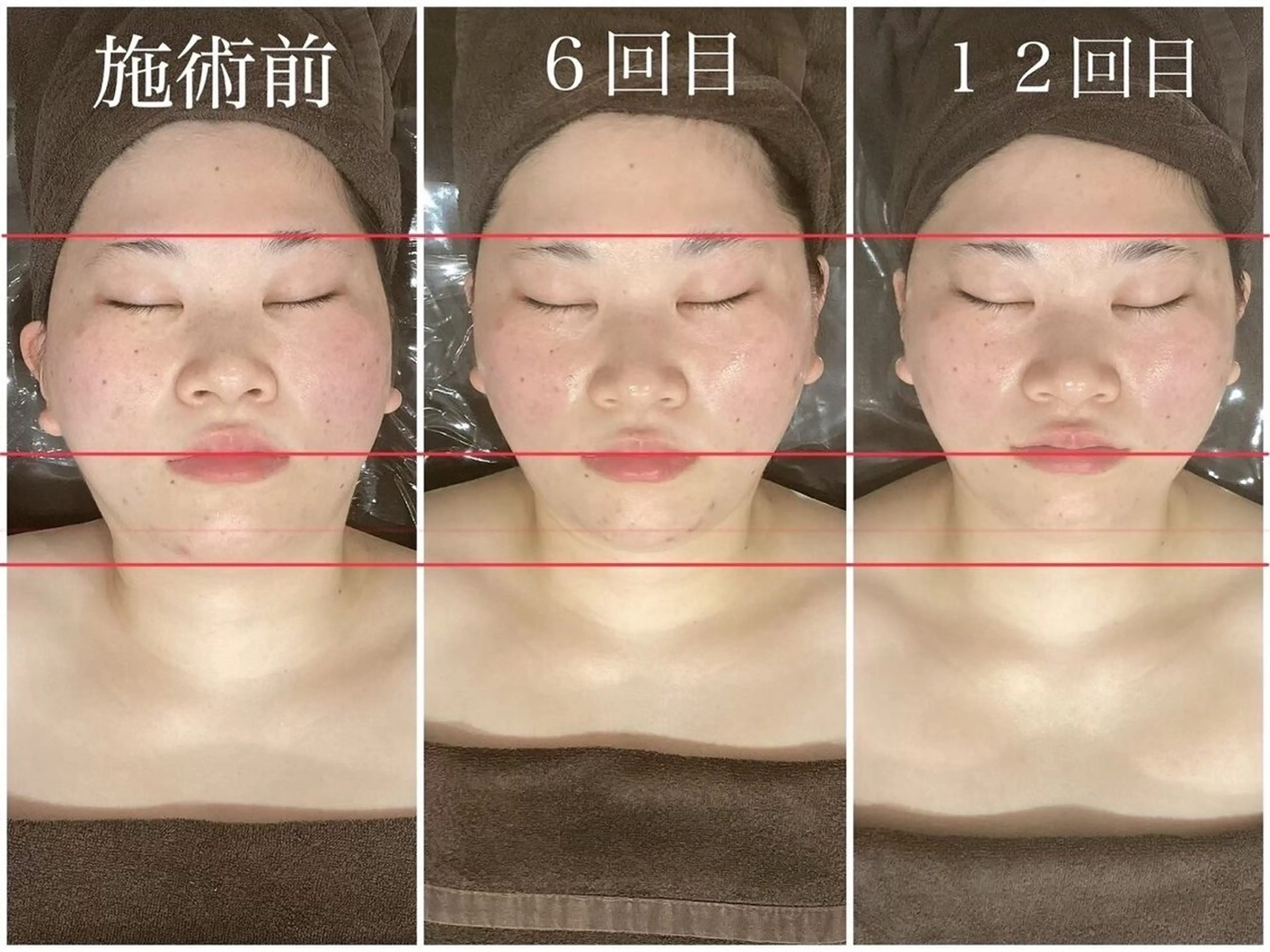 エステ リラク コルギと痩身の専門店 🌿✨堀江りなのエステ・リラクイメージ