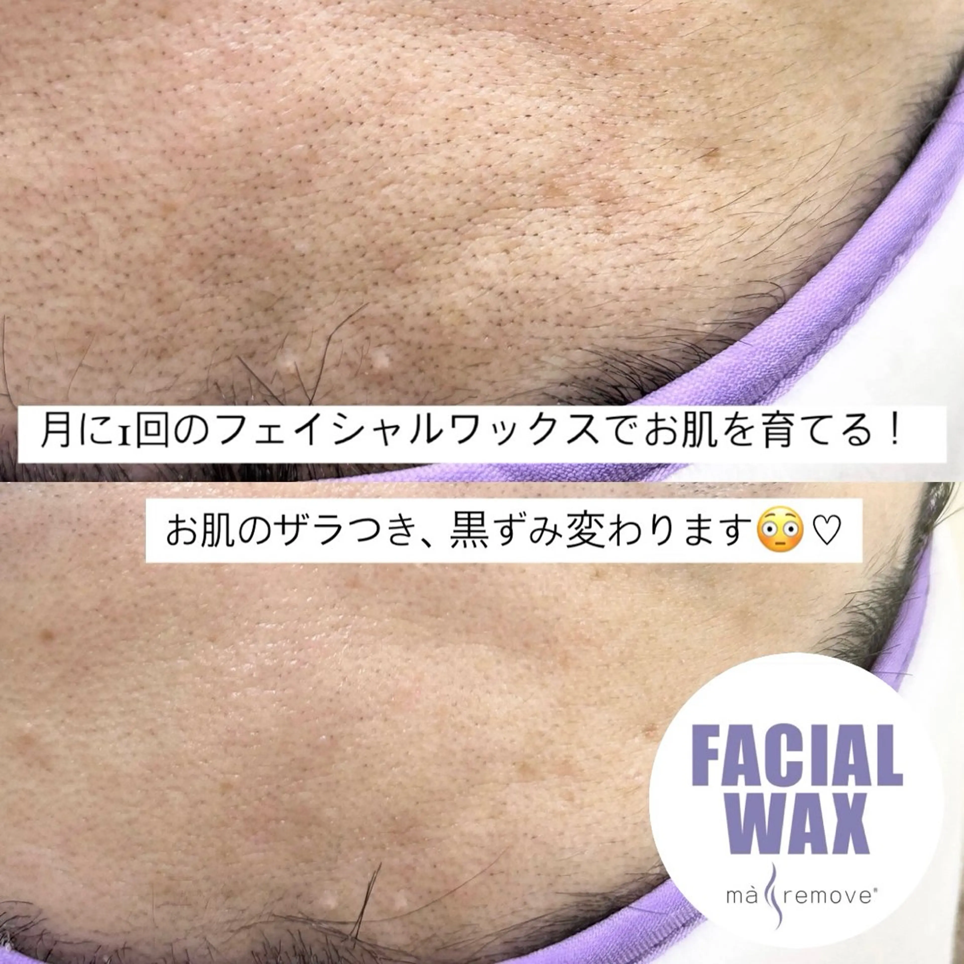 脱毛 Eyelash Lirio所属・EyeLash Lirio リリオのエステ・リラクイメージ