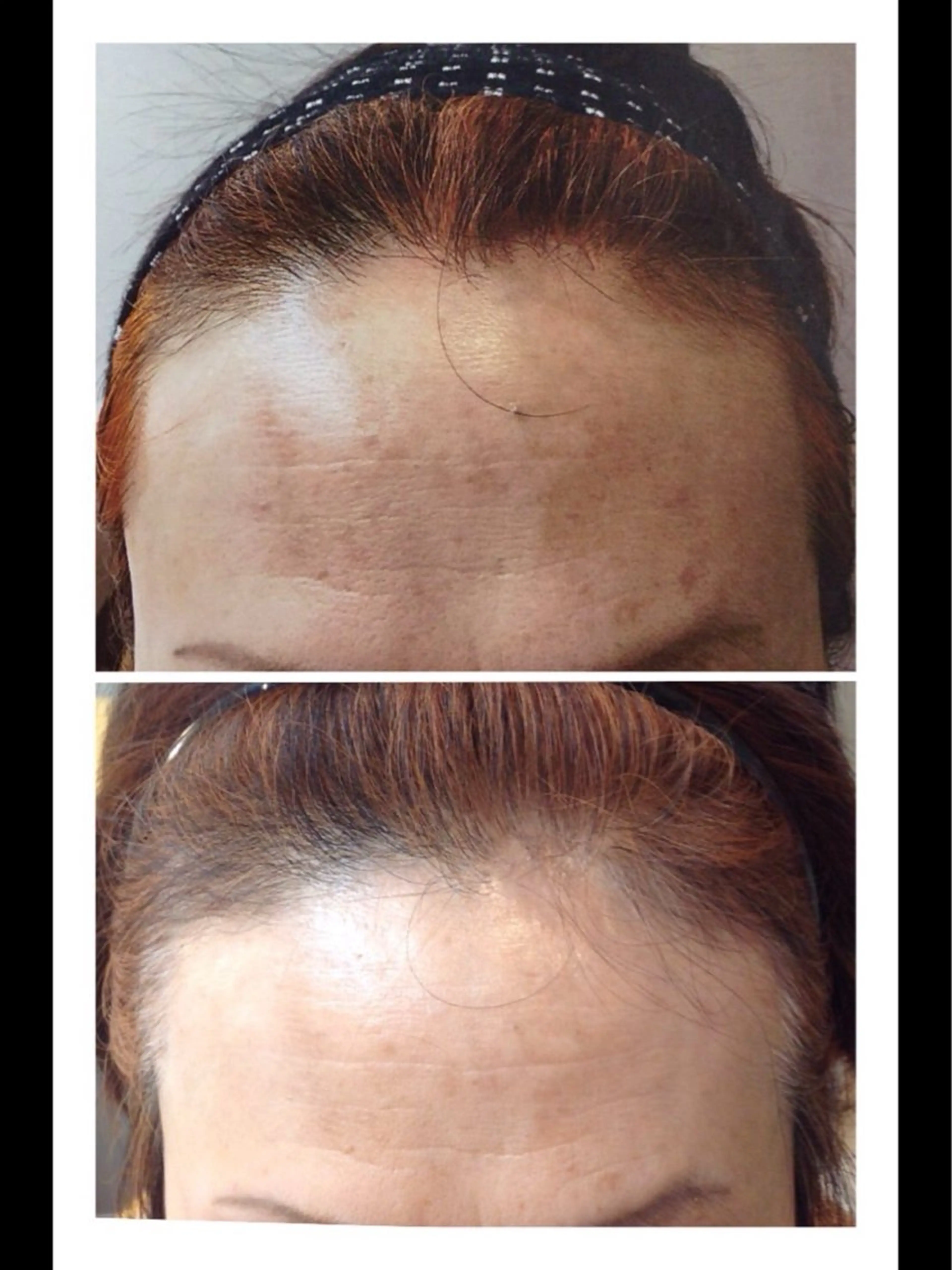 小顔・ツルツル素肌 ハリステリアのエステ・リラクイメージ