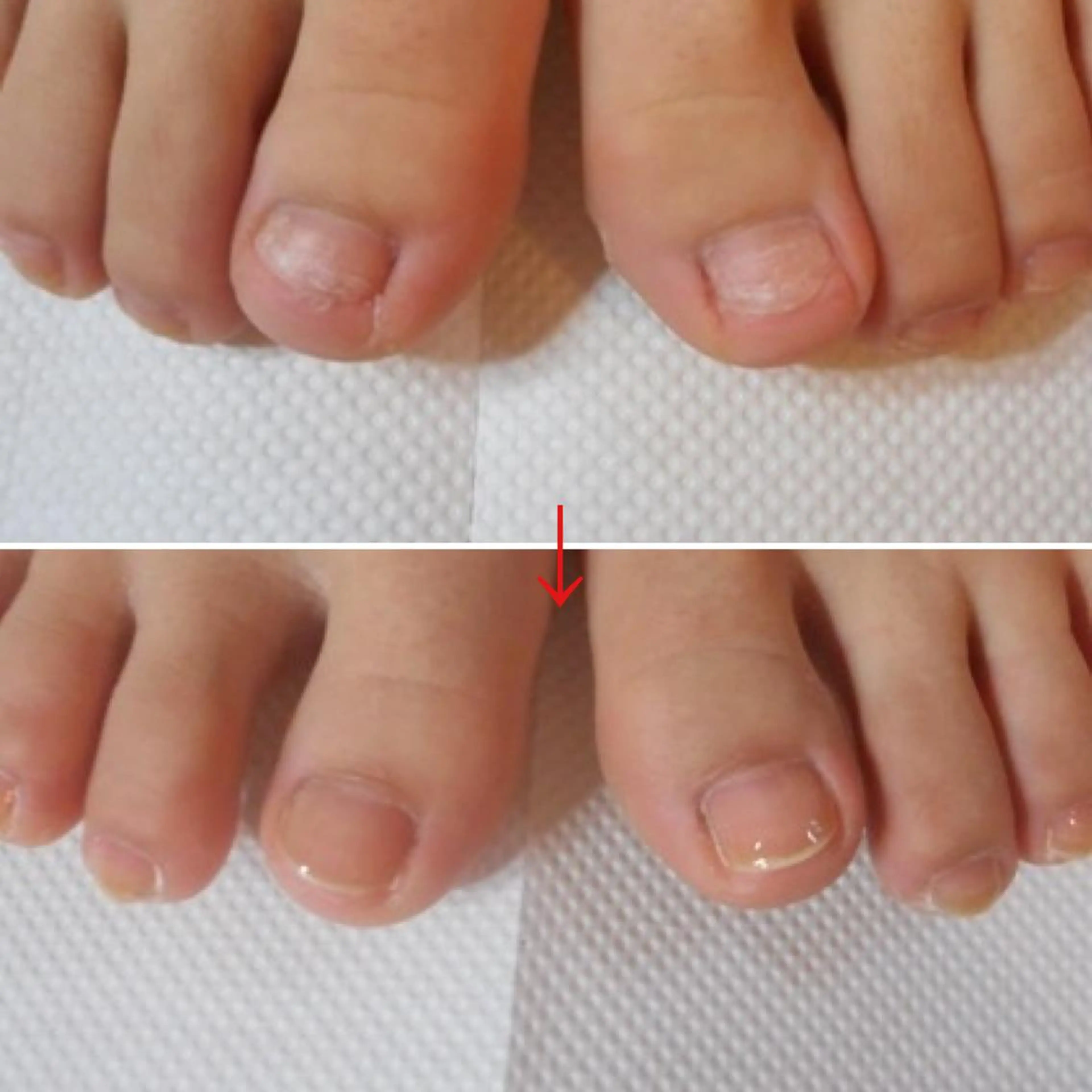 ネイル 卒業式 フットネイル ネイルサロンアリューム所属・ネイルサロン アリュームのネイルデザイン