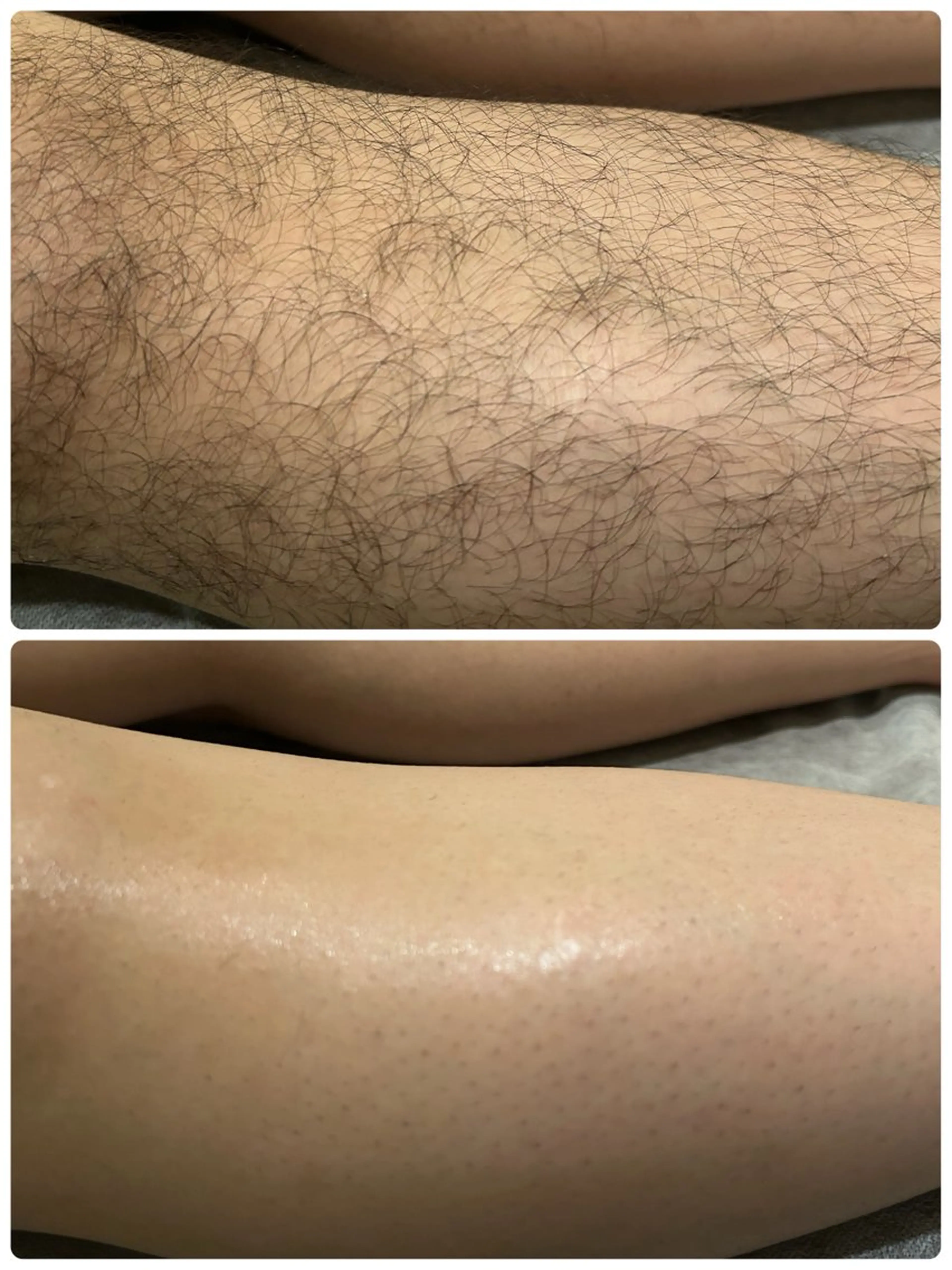 メンズ Chainon Beautyのエステ・リラクイメージ