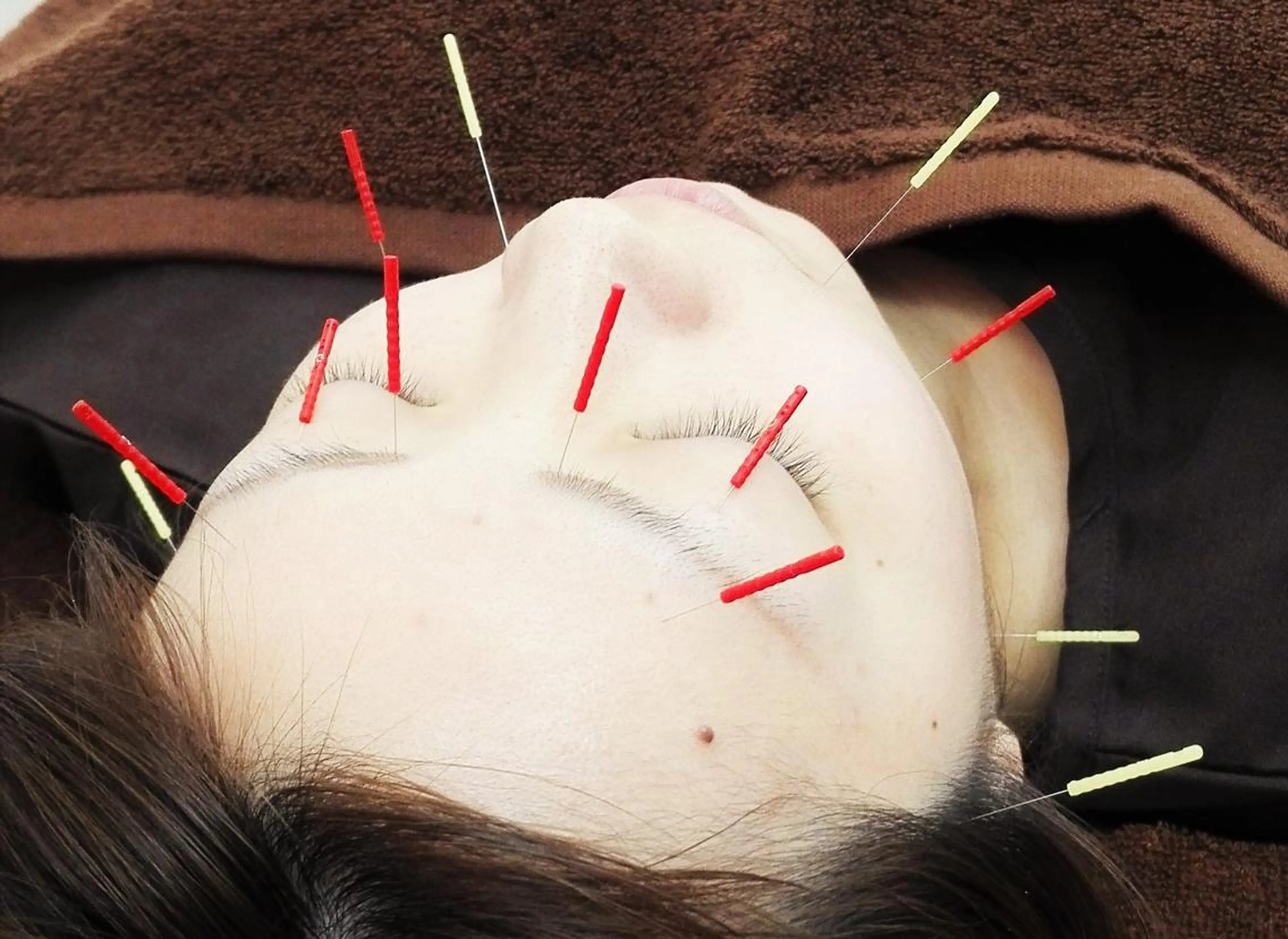 【イベント前の駆け込みプラン】150分⭐️結婚鍼の写真