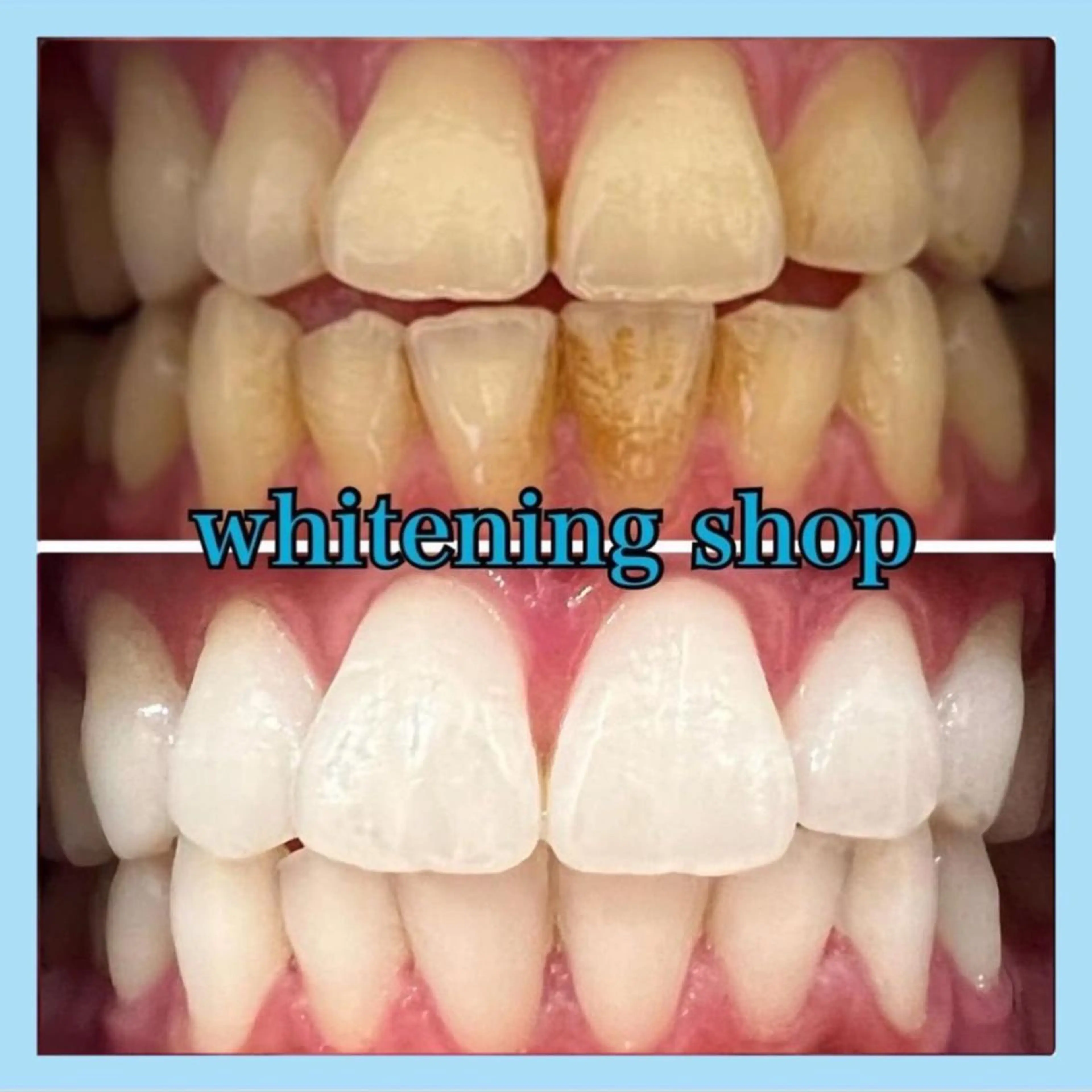 ホワイトニング ショップ千葉店のその他イメージ