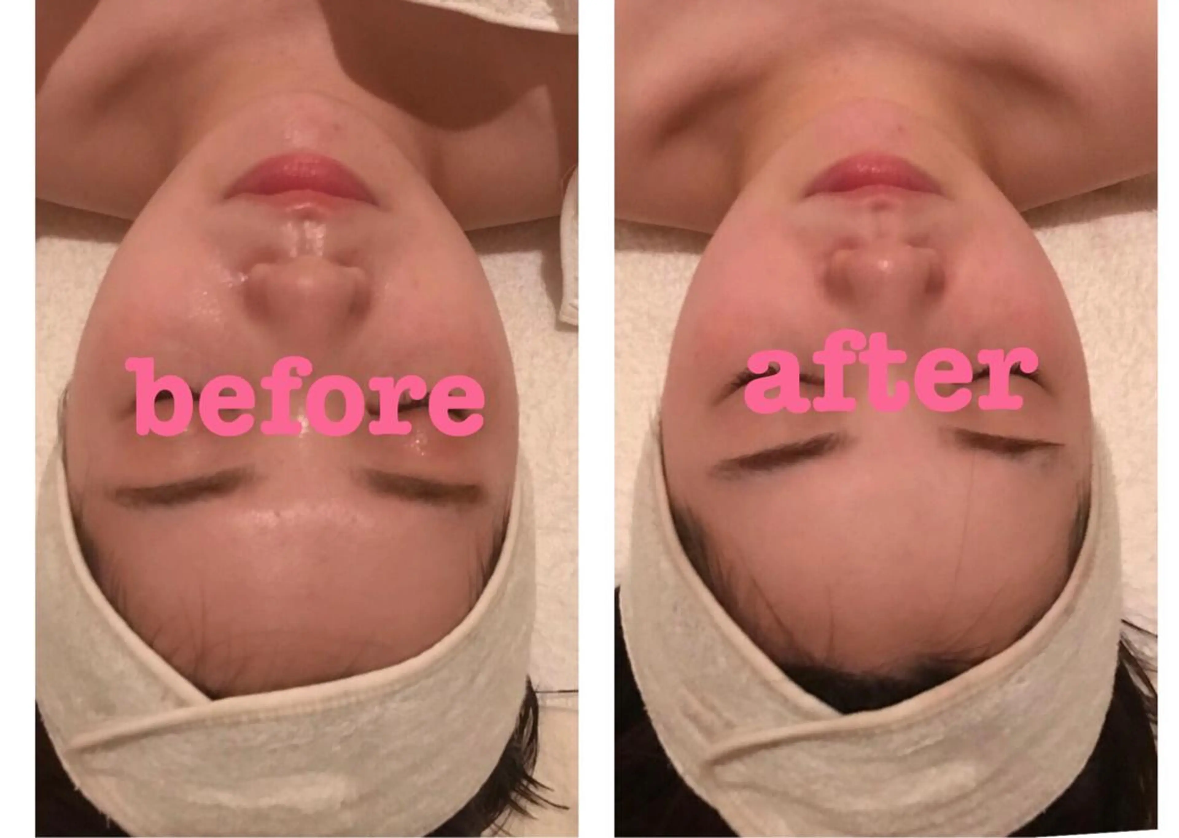 1回で効果実感☆小顔・透明感・無料ﾌｪｲｼｬﾙモニター💆🏻‍♀️✨口ｺﾐ書いてくださる方限定🙇‍♀️の写真