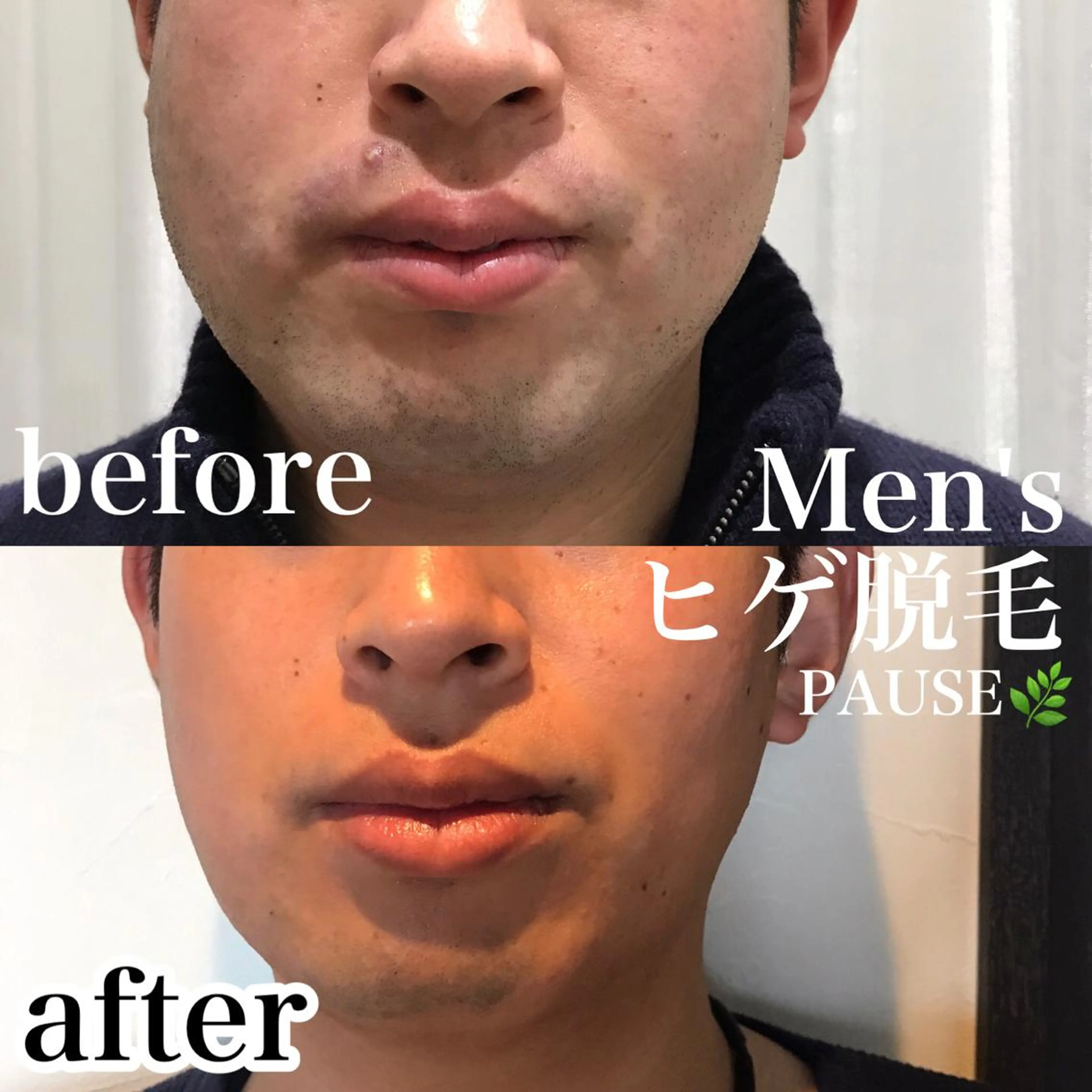 脱毛 浜野 恵美のエステ・リラクイメージ