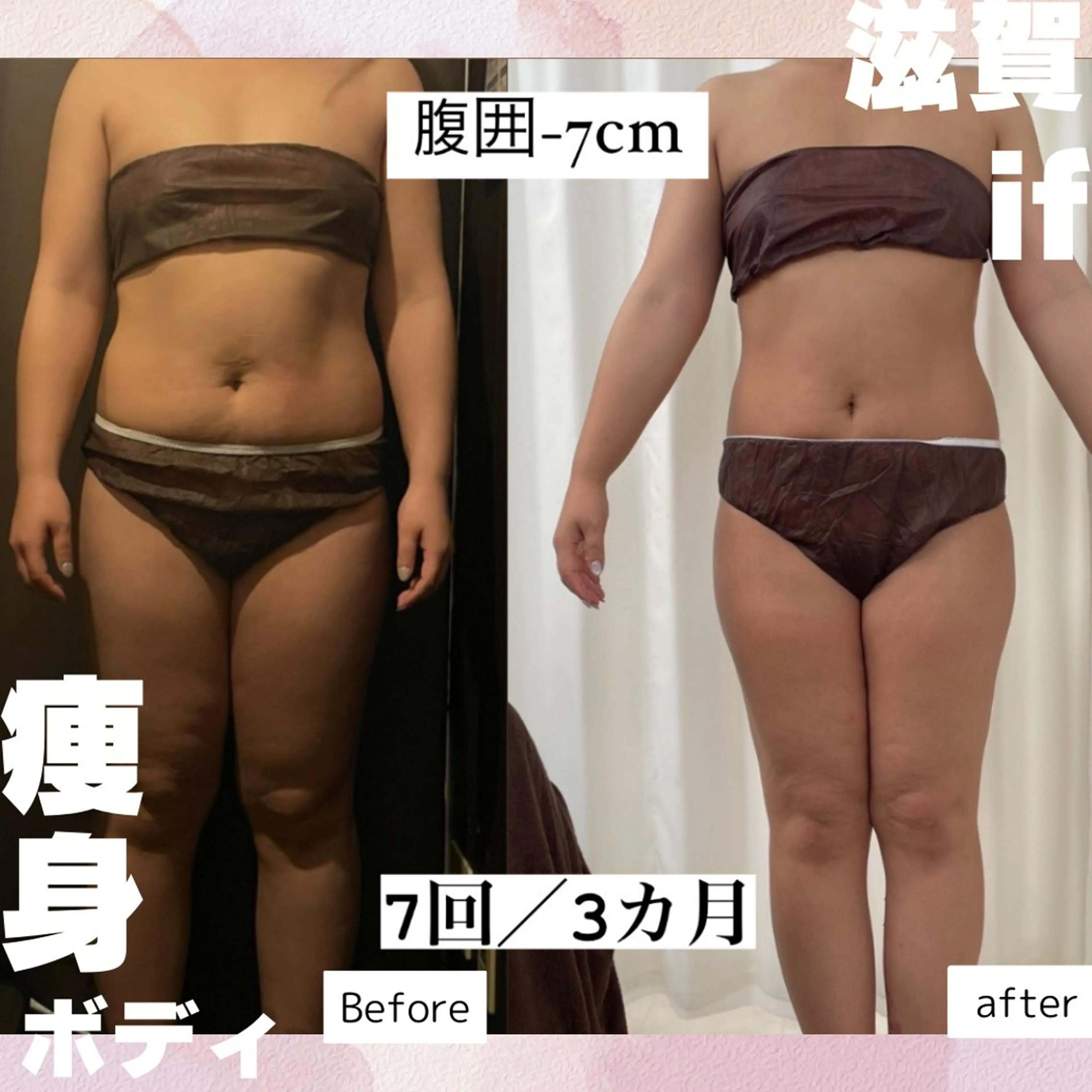 痩身・フェイシャル/if byOrabriller所属・if byOrab riller【イフ】のその他イメージ